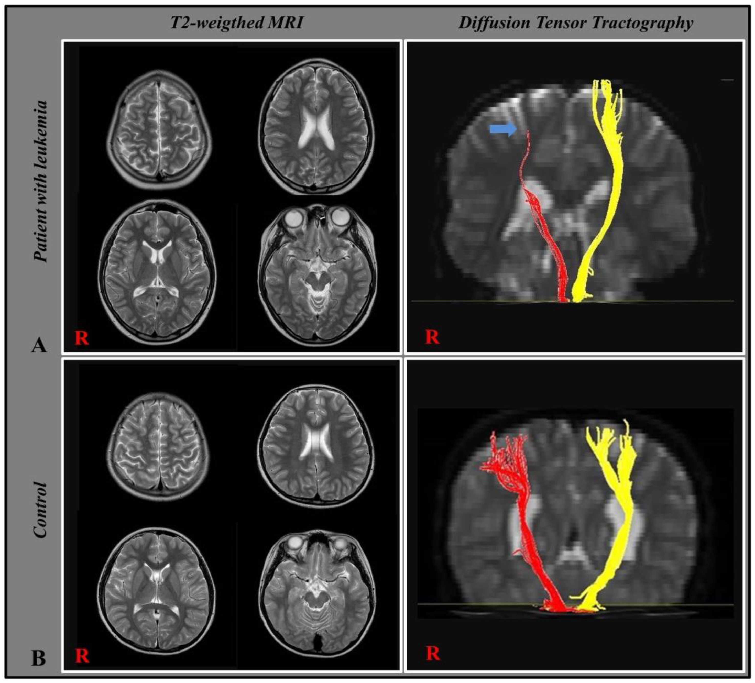 Children 10 00224 g001