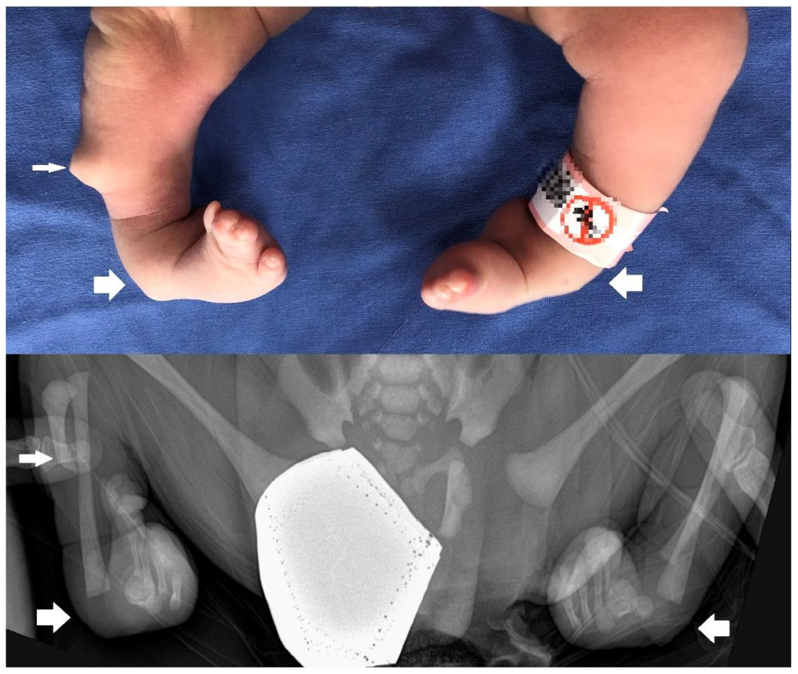 Children 10 00228 g001 Children 10 00228 g001