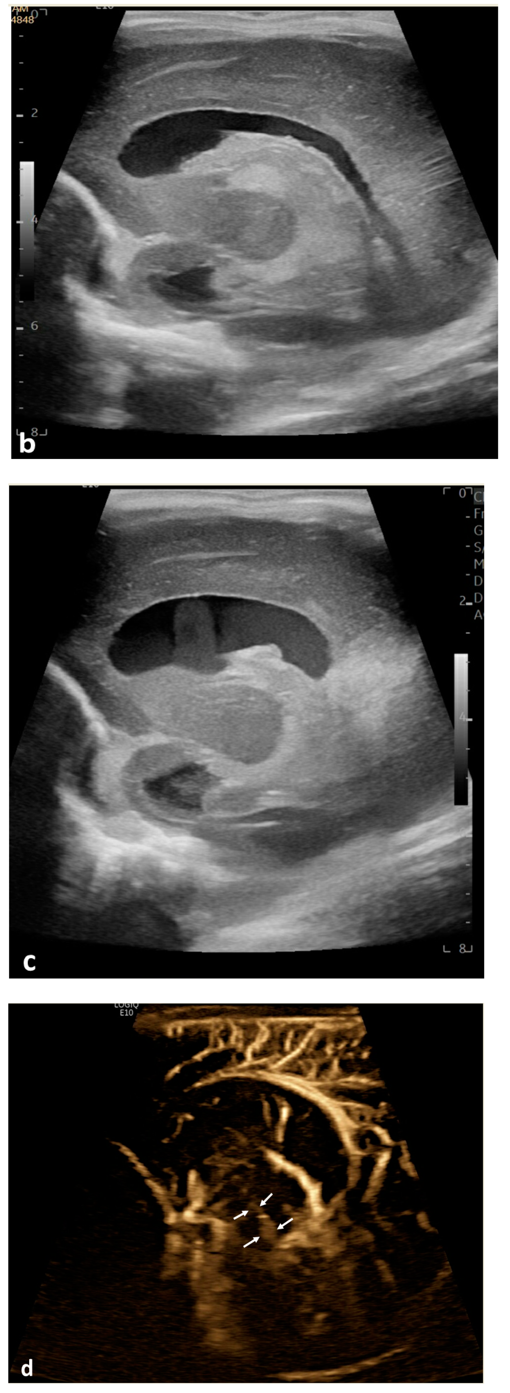 Children 10 00245 g002b