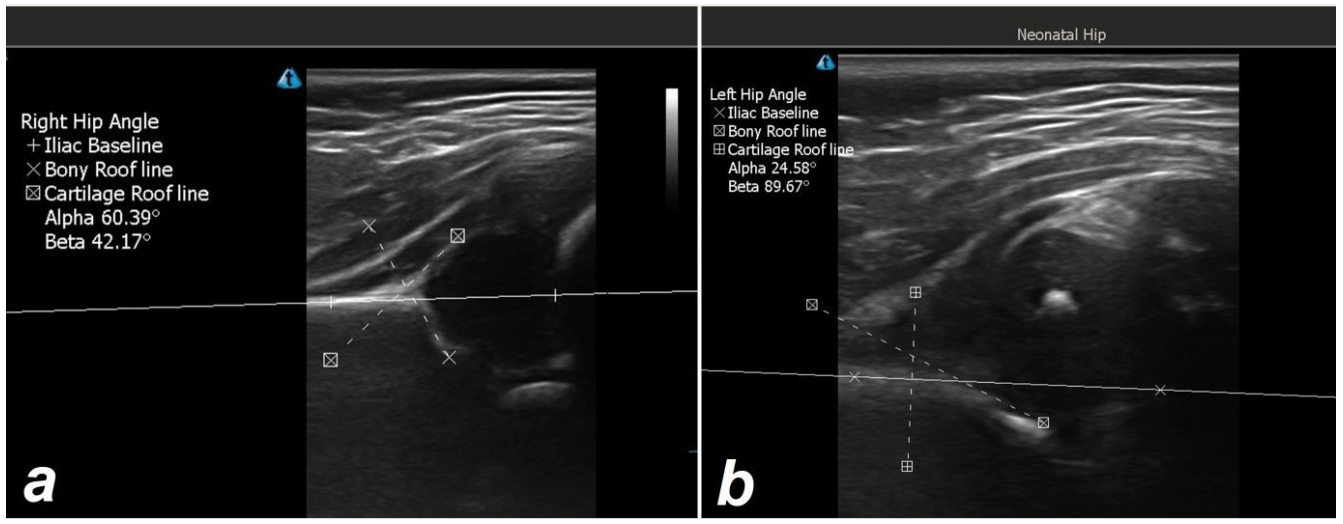 Children 10 00304 g003