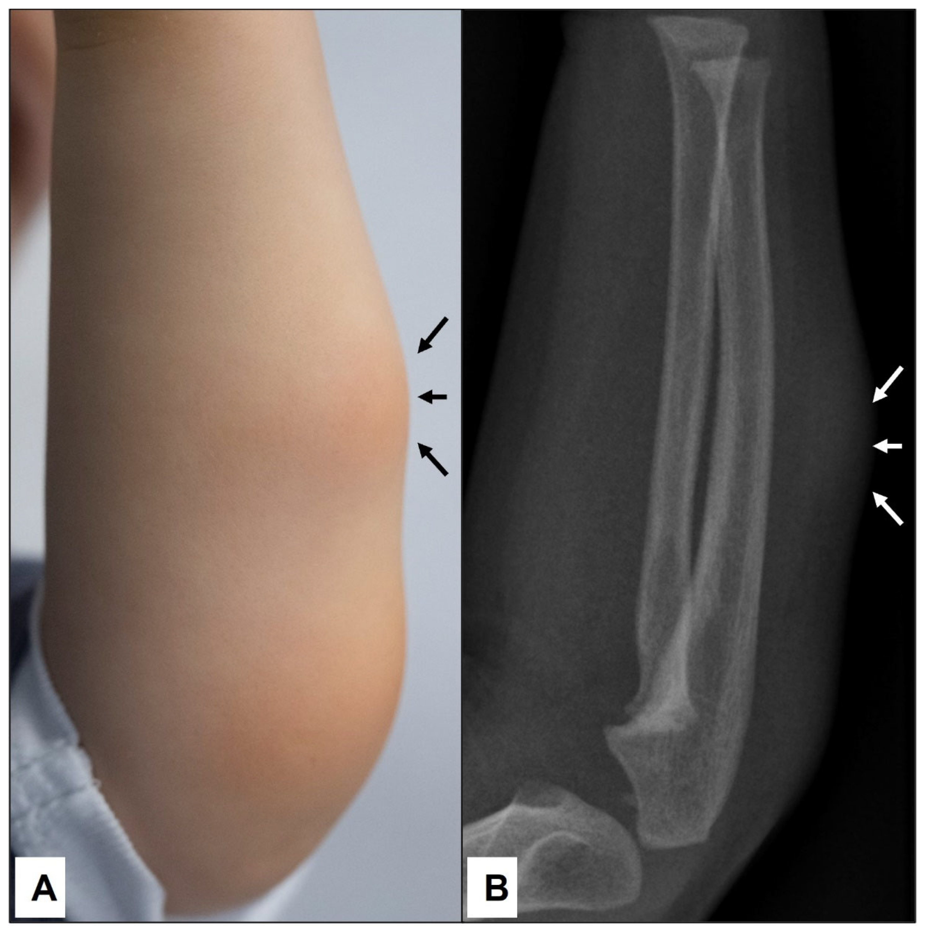 Children 10 00362 g003