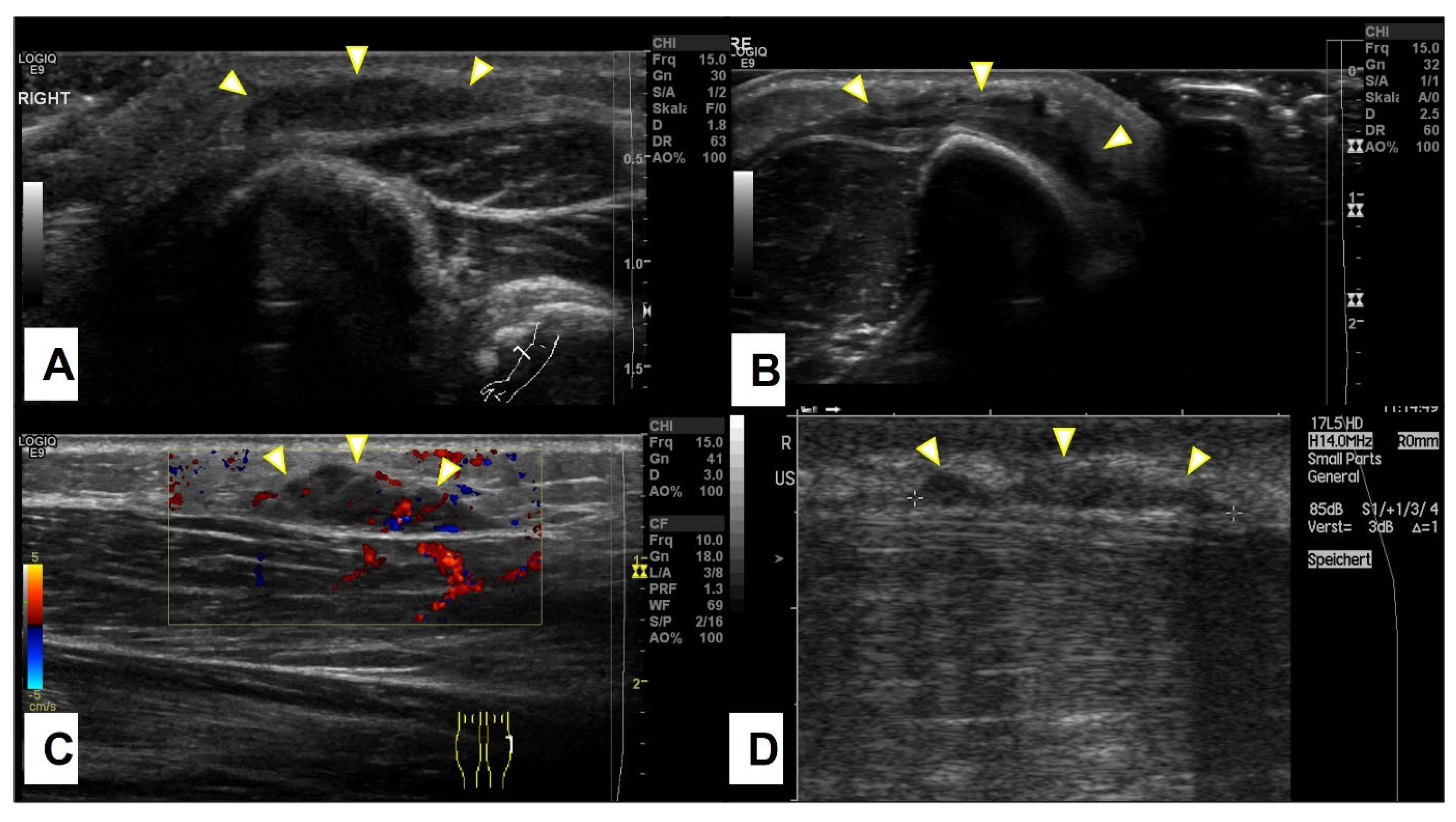 Children 10 00362 g004