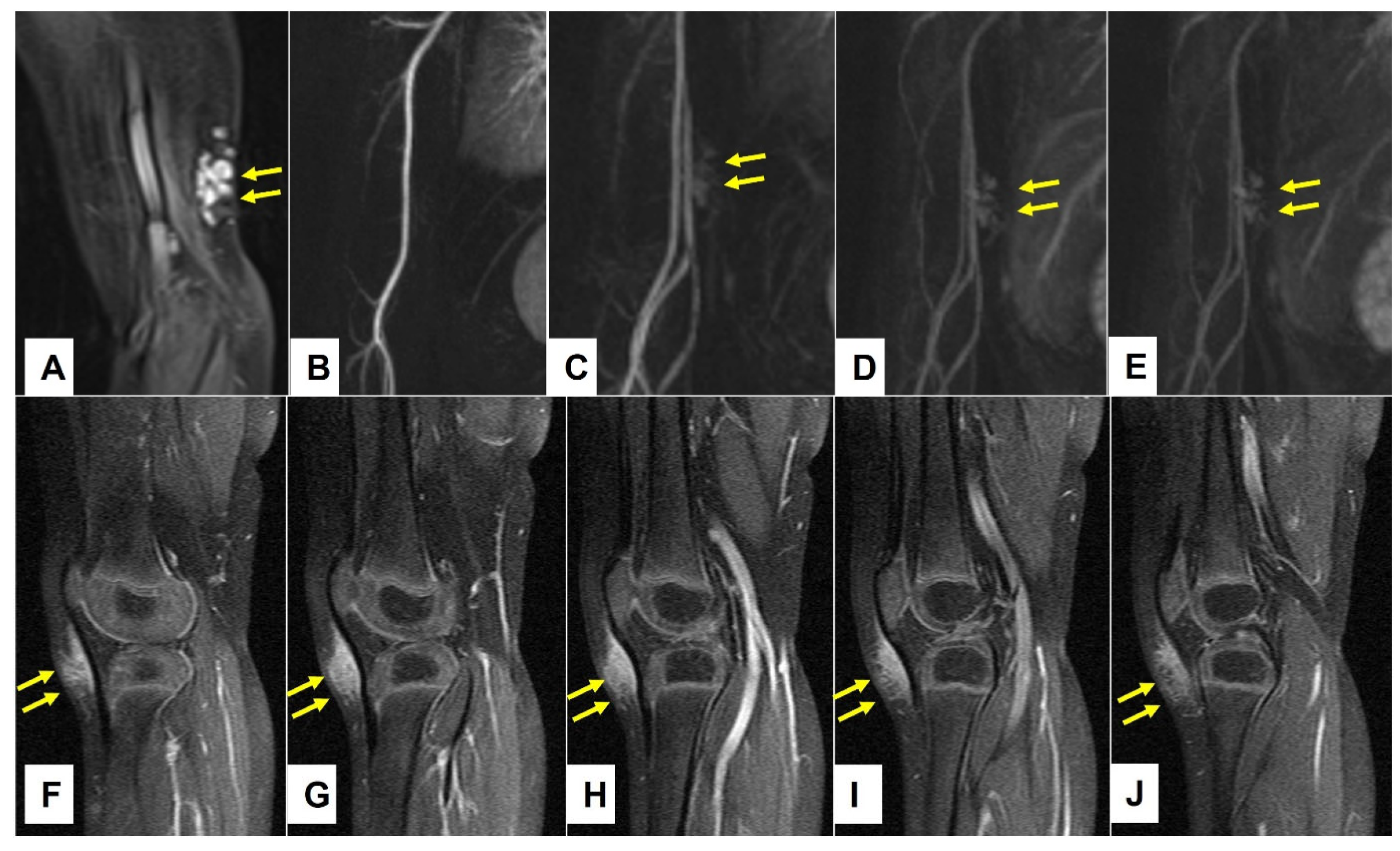 Children 10 00362 g011