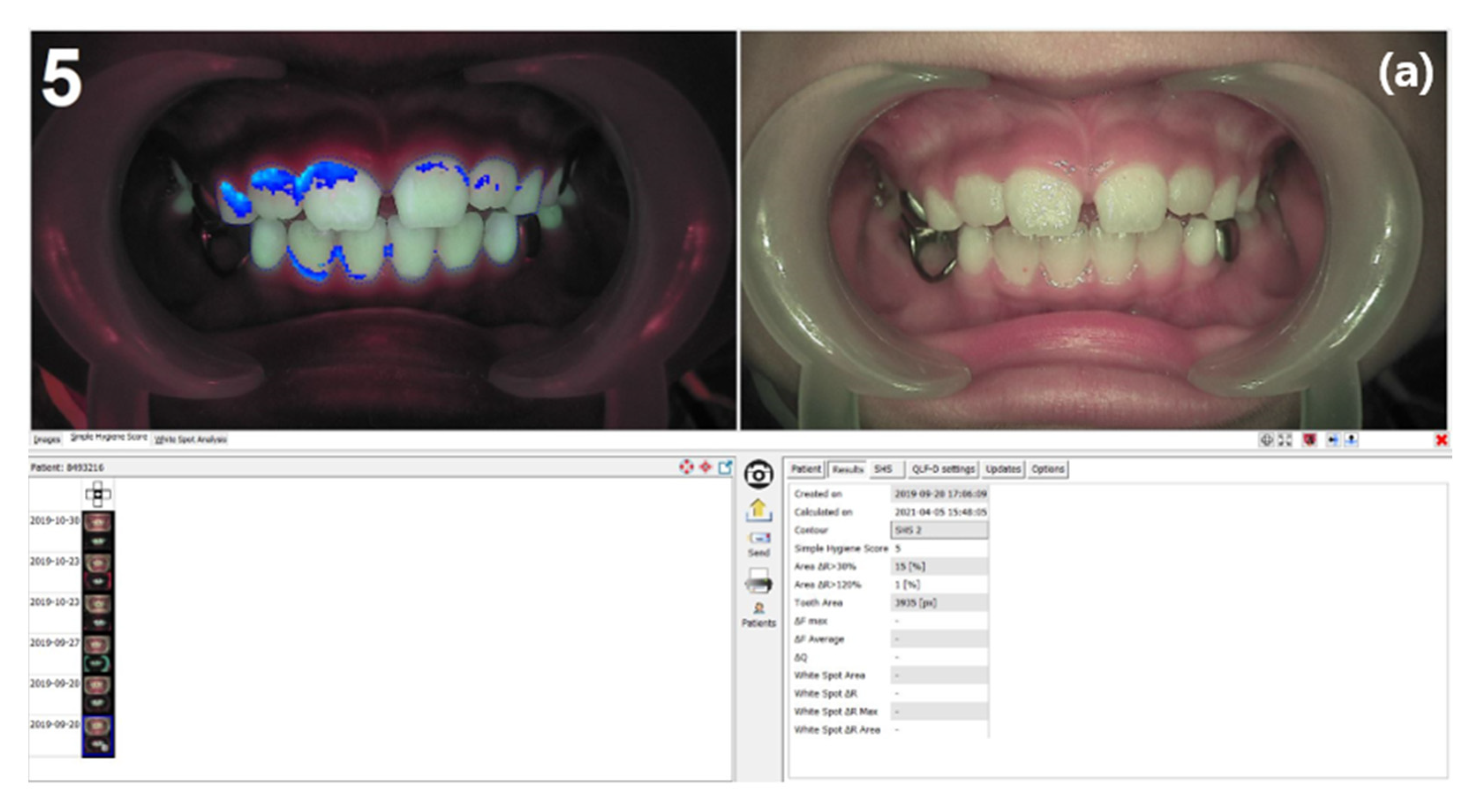 Children 10 00429 g005a Children 10 00429 g005a