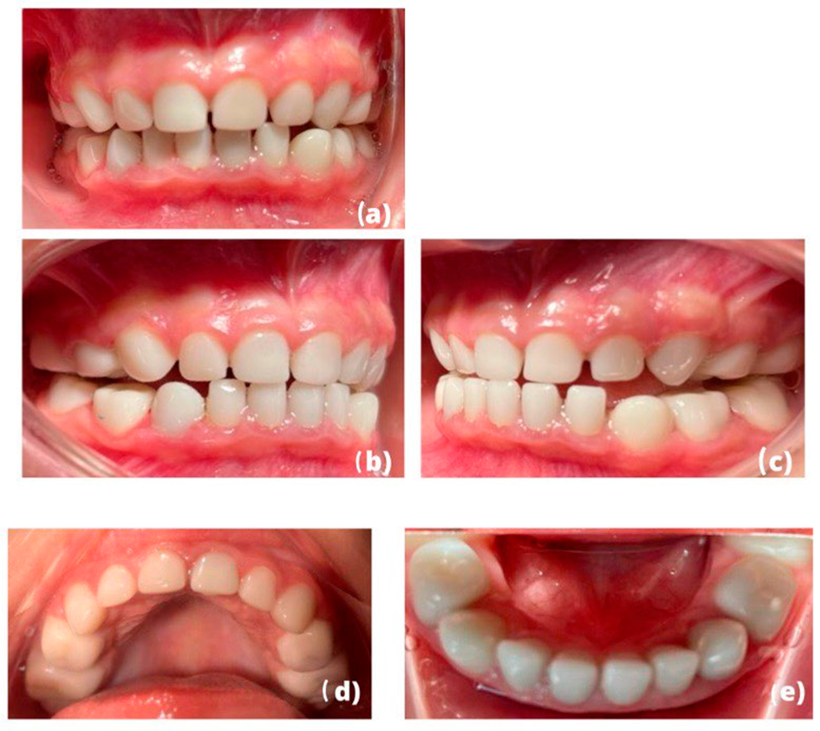 Children 10 00488 g004