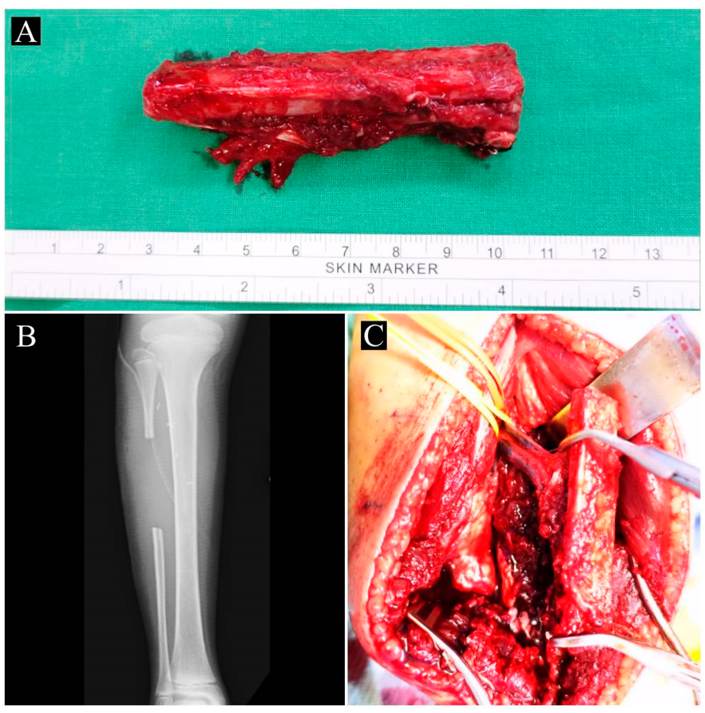 Children 10 00503 g003