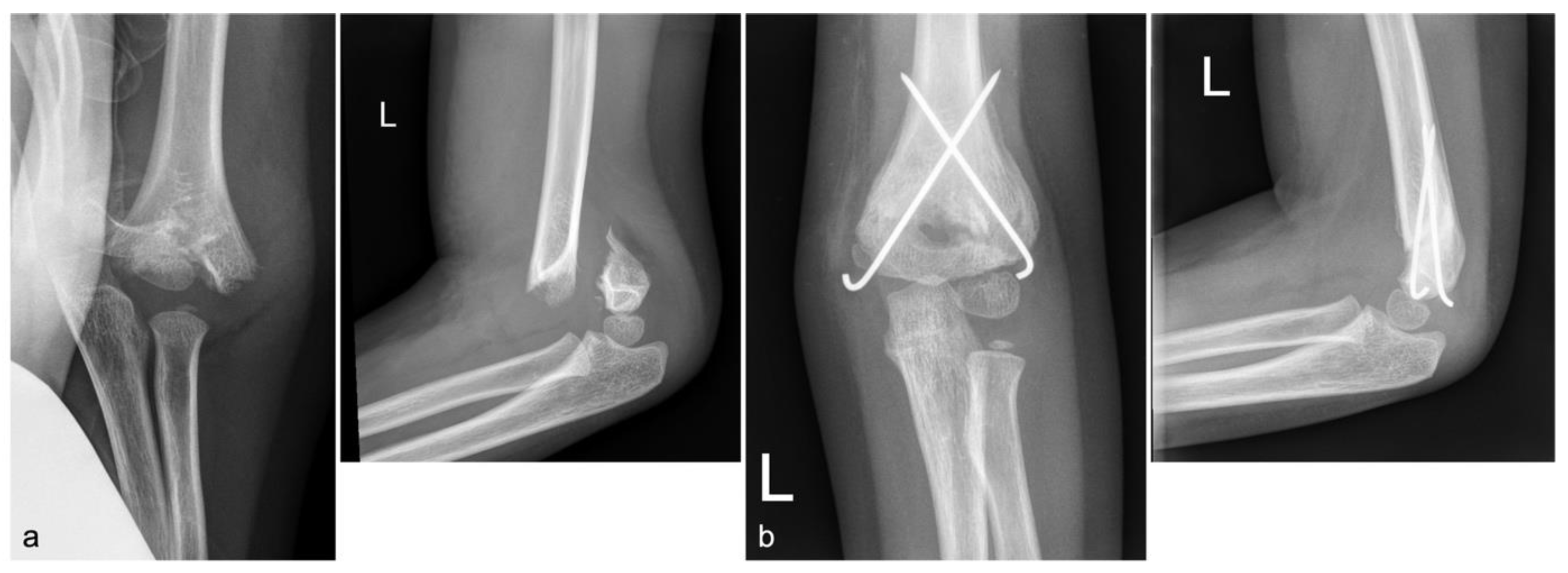 Children 10 00510 g003