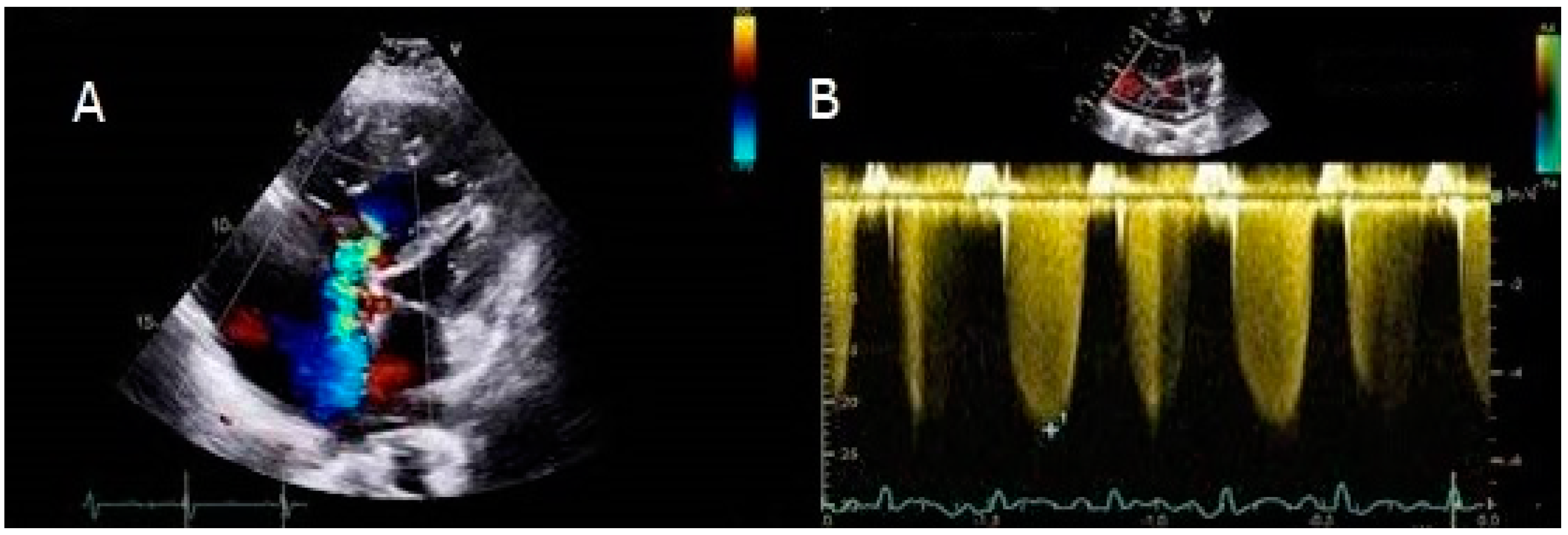 Children 10 00518 g001 Children 10 00518 g001