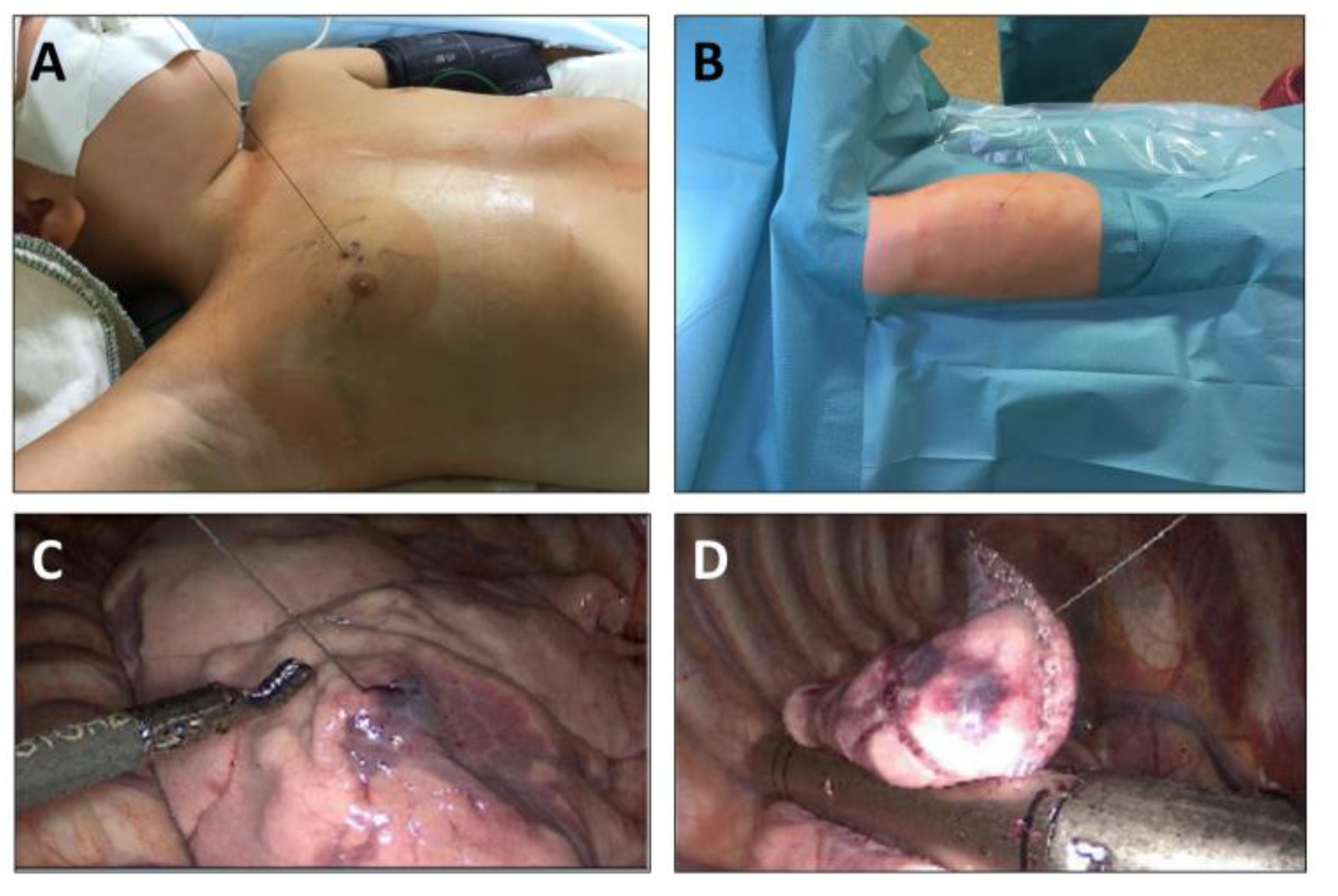 Children 10 00542 g002 Children 10 00542 g002