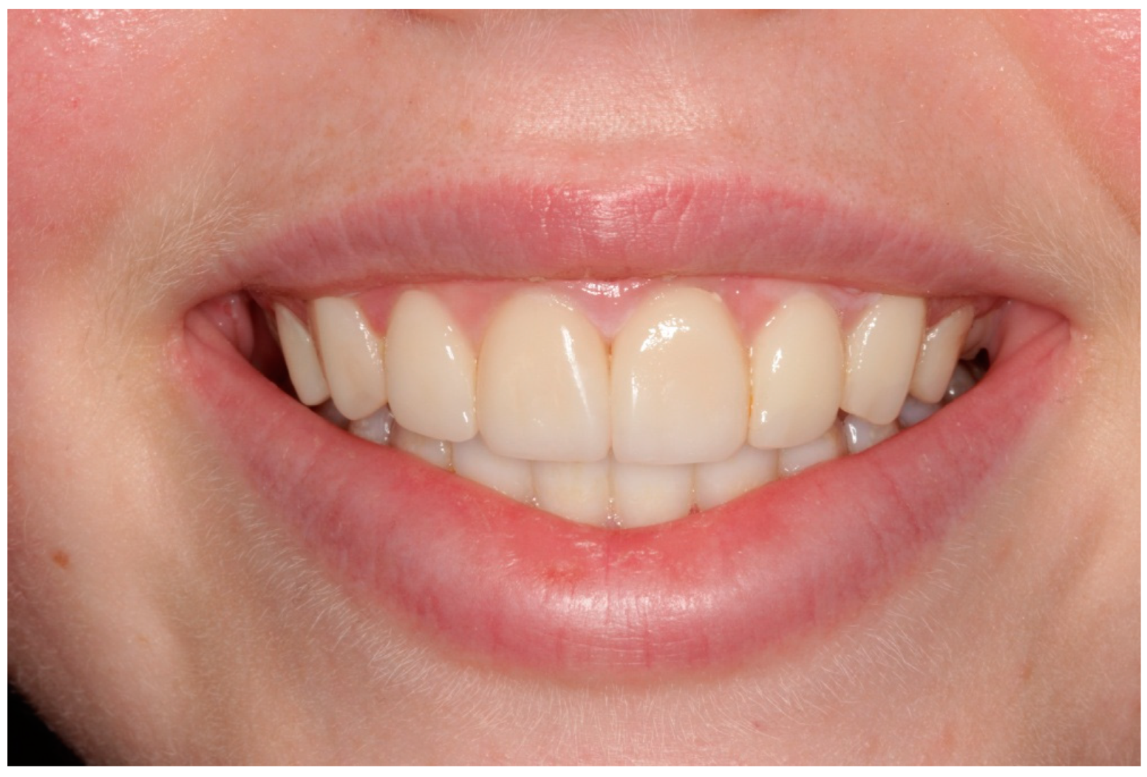 Children 10 00546 g003