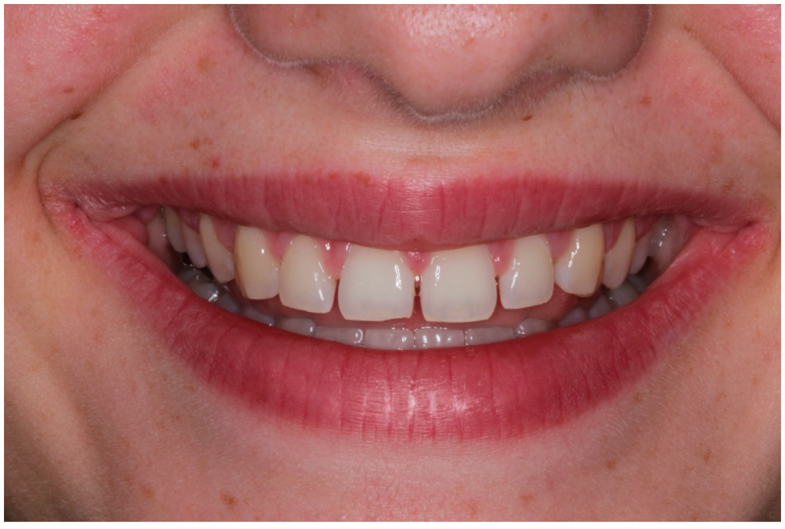 Children 10 00546 g004