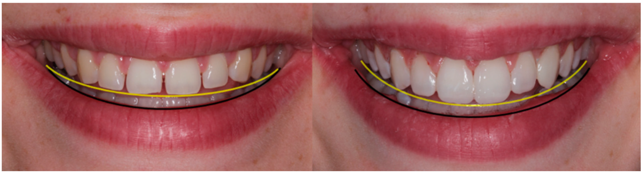 Children 10 00546 g005