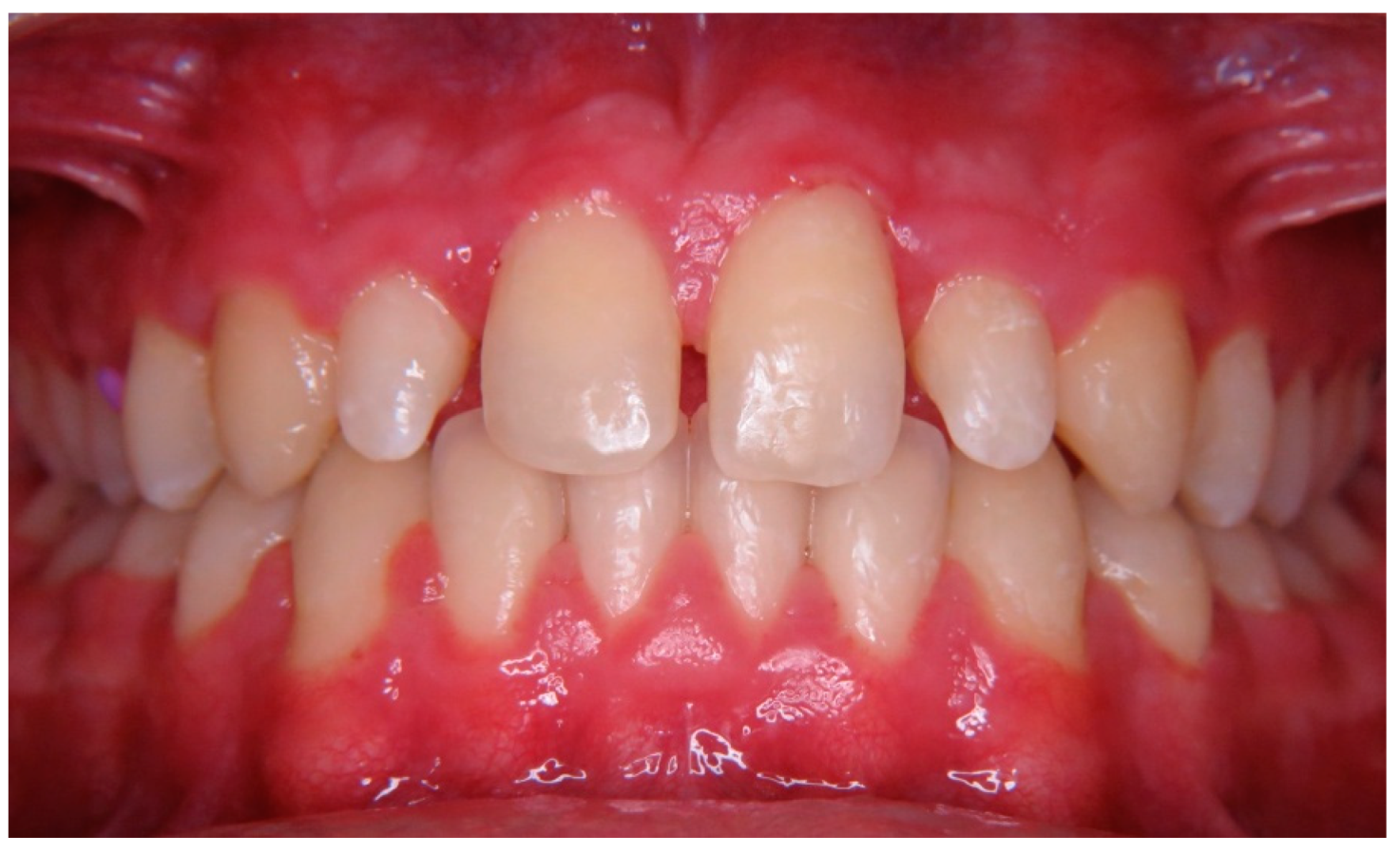 Children 10 00546 g008