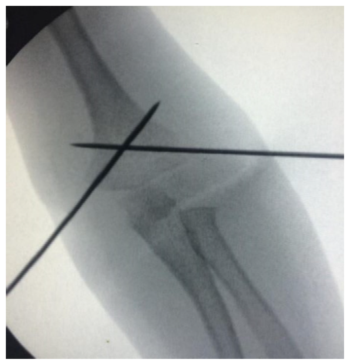 Children 10 00550 g003 Children 10 00550 g003