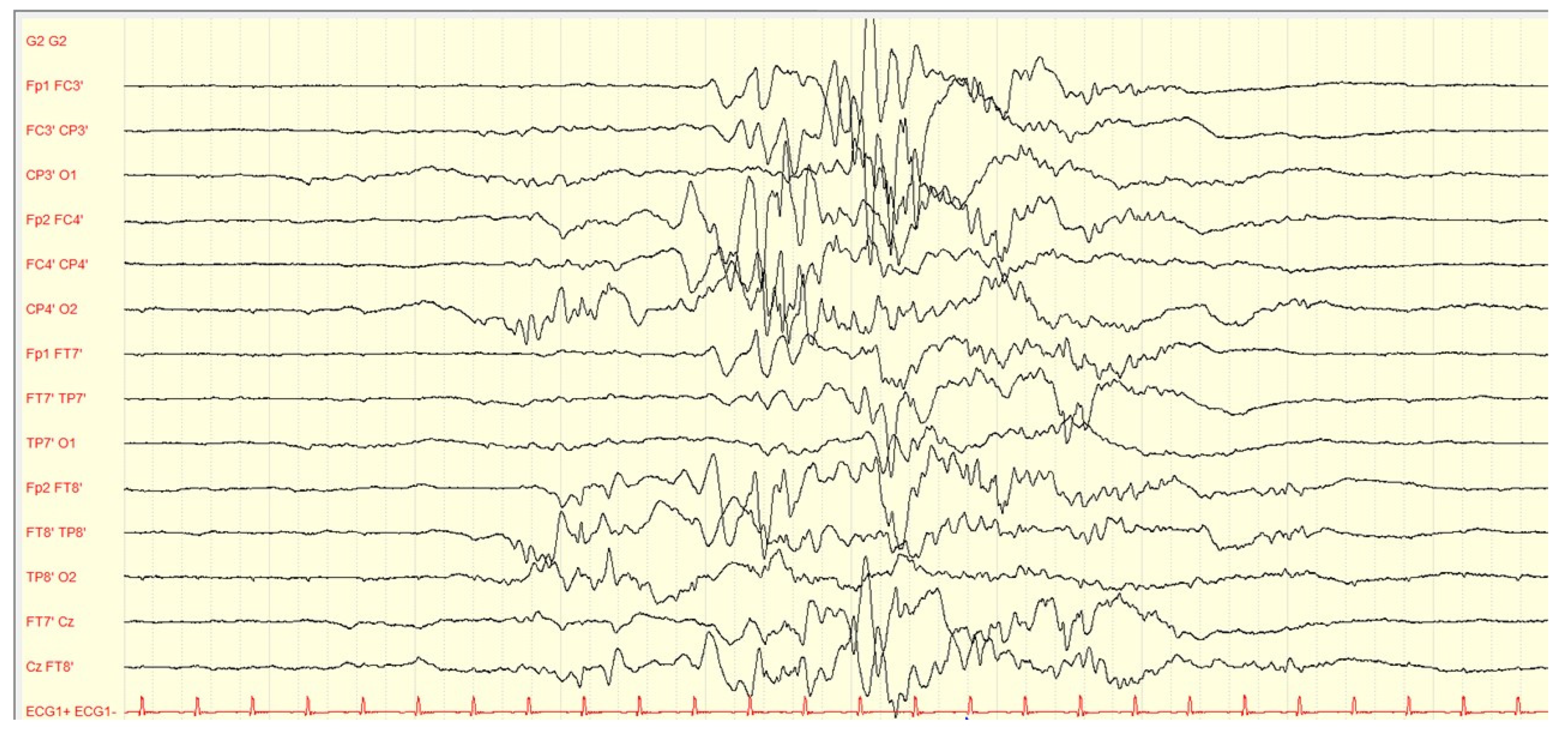 Children 10 00553 g002 Children 10 00553 g002