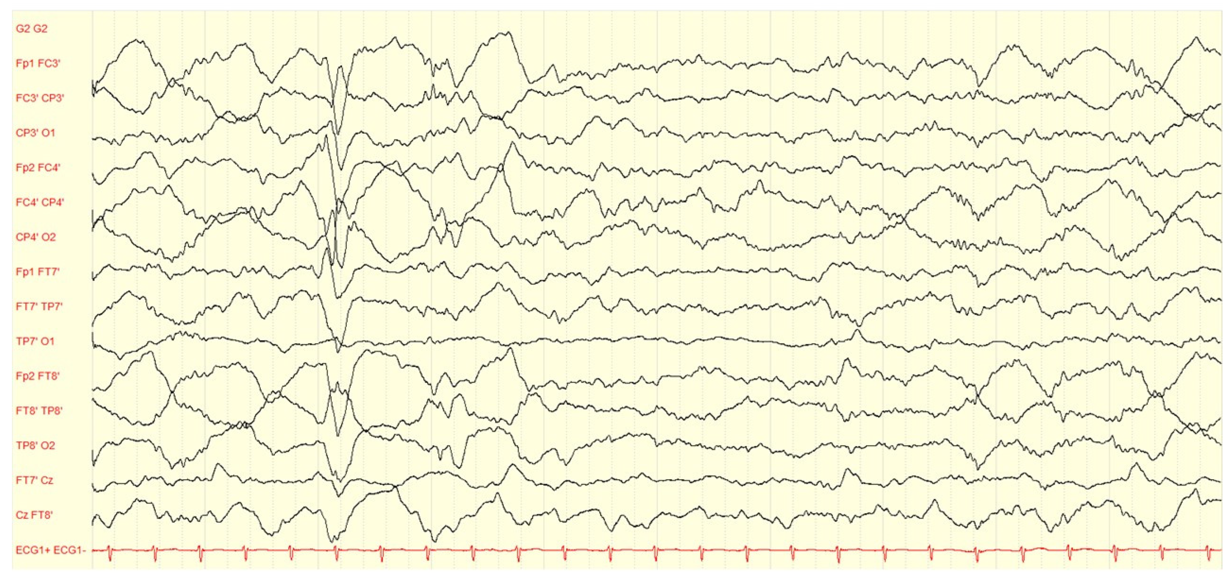 Children 10 00553 g003 Children 10 00553 g003