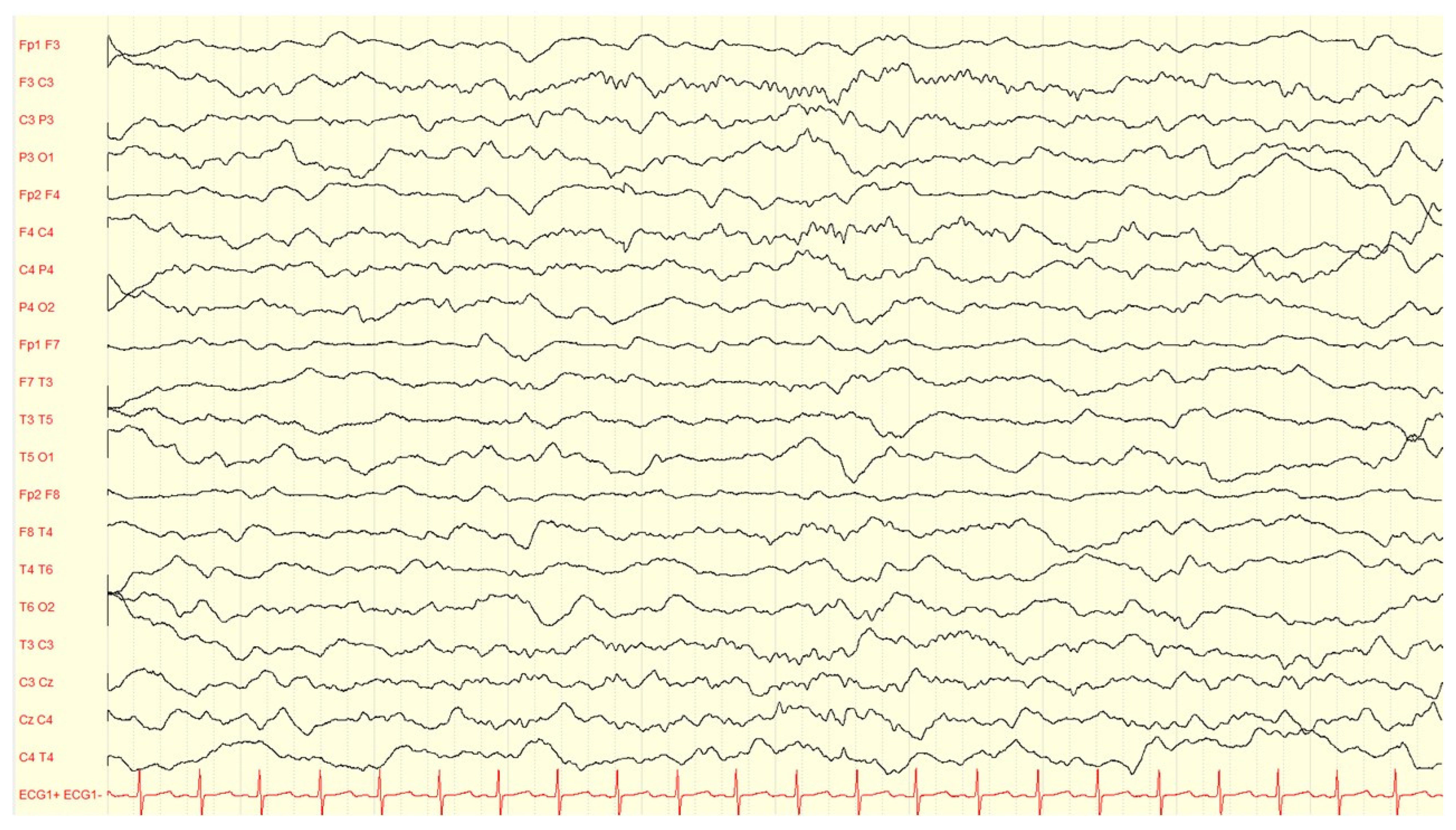 Children 10 00553 g004 Children 10 00553 g004