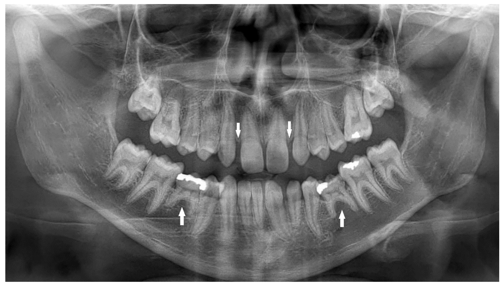 Children 10 00596 g002 Children 10 00596 g002