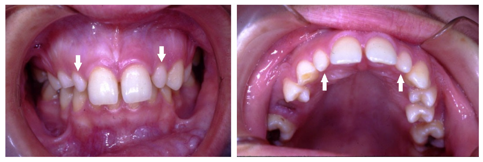 Children 10 00596 g004 Children 10 00596 g004