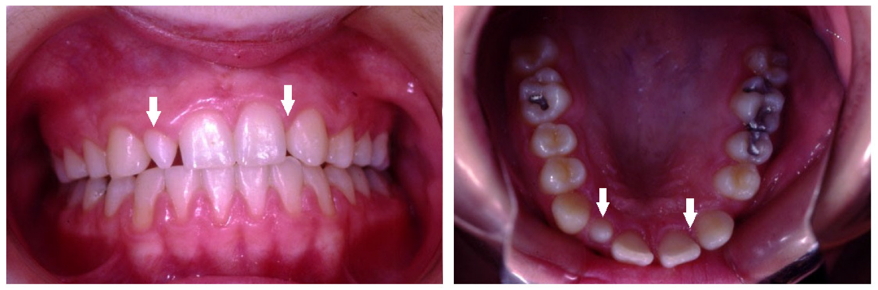 Children 10 00596 g005 Children 10 00596 g005