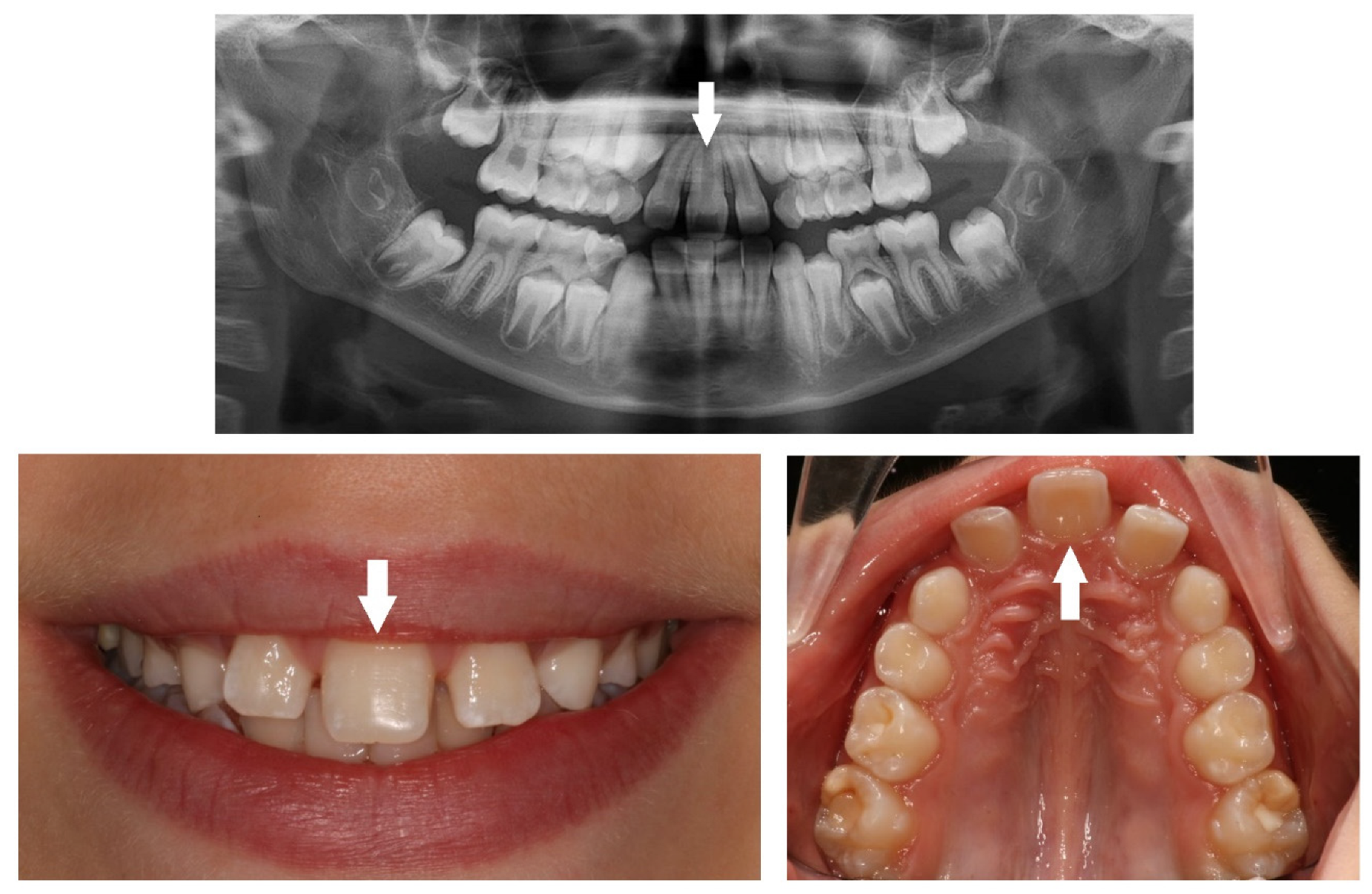 Children 10 00596 g007 Children 10 00596 g007