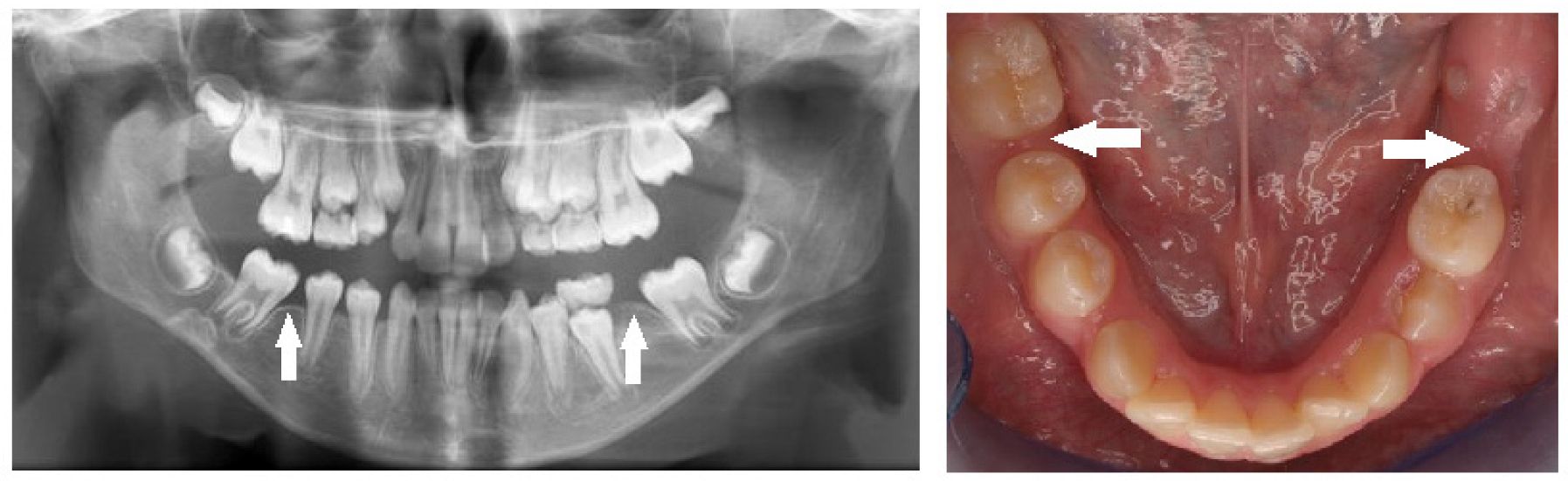 Children 10 00596 g008 Children 10 00596 g008