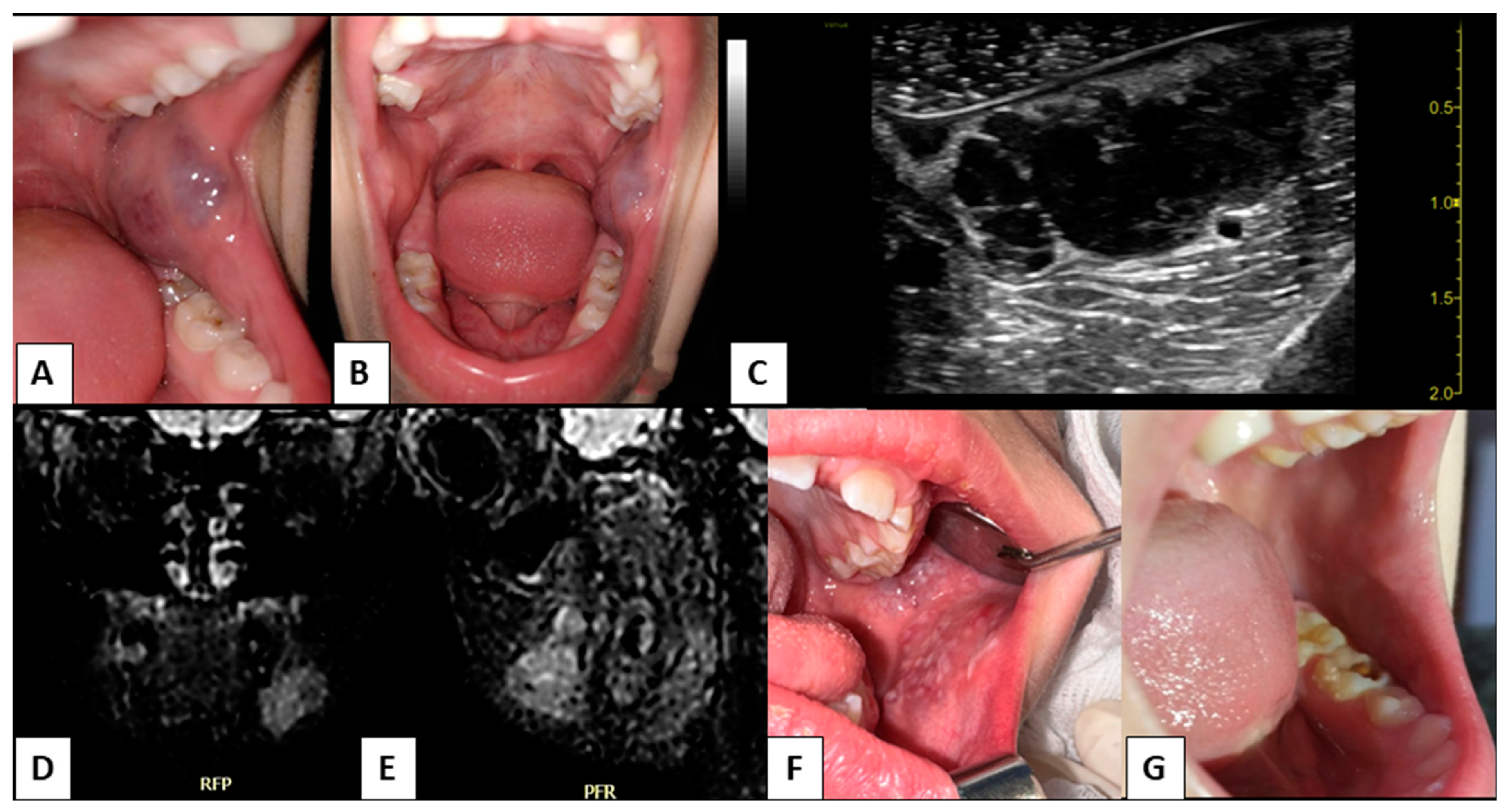 Children 10 00611 g001 Children 10 00611 g001