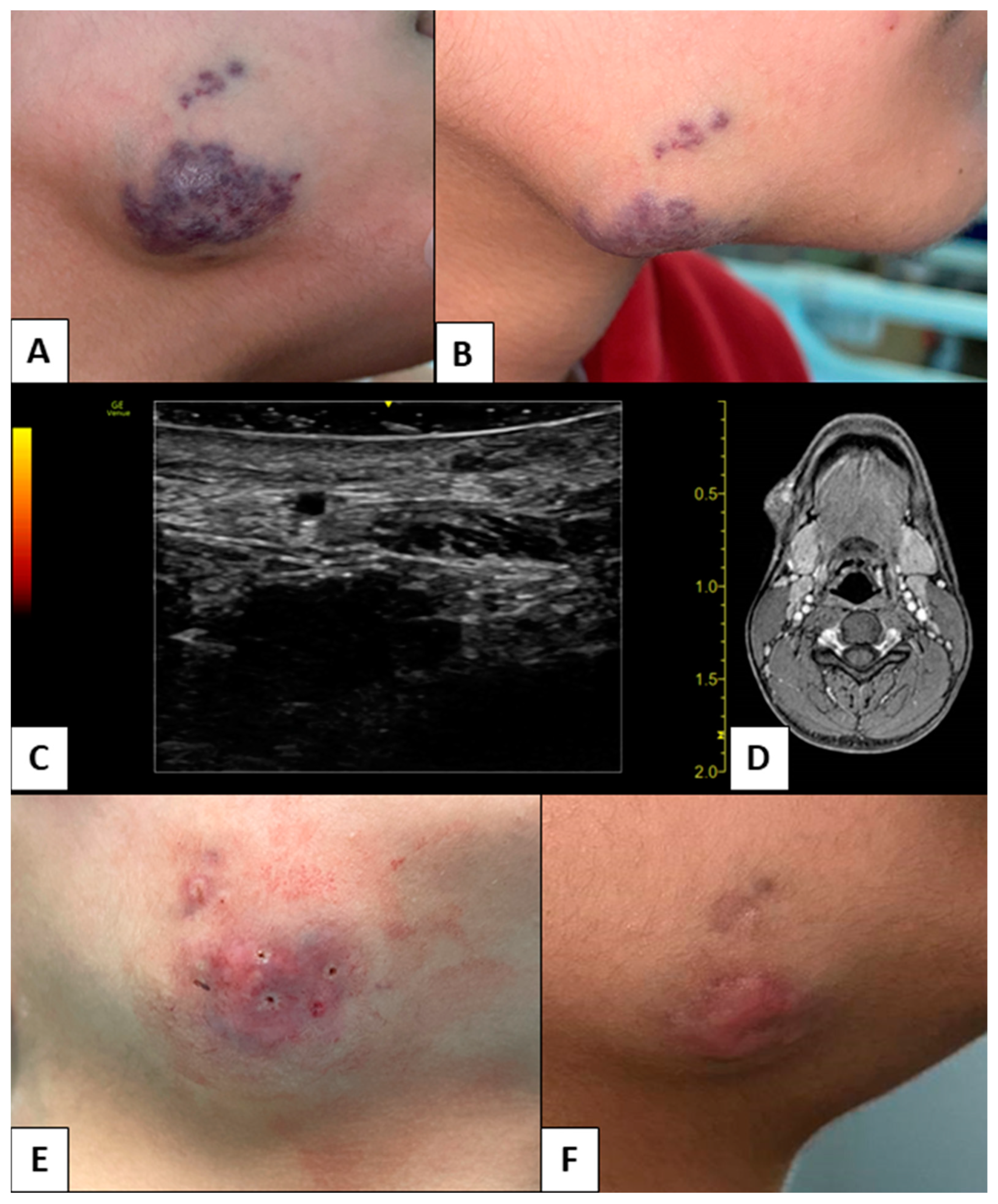 Children 10 00611 g002 Children 10 00611 g002