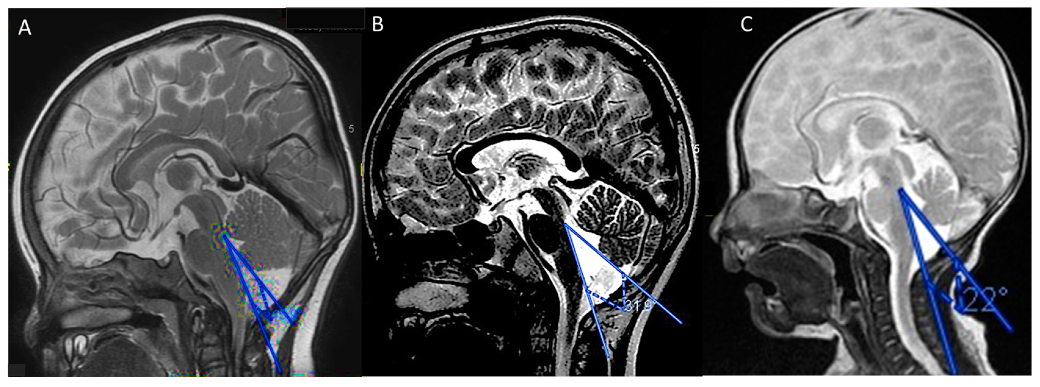 Children 10 00621 g001