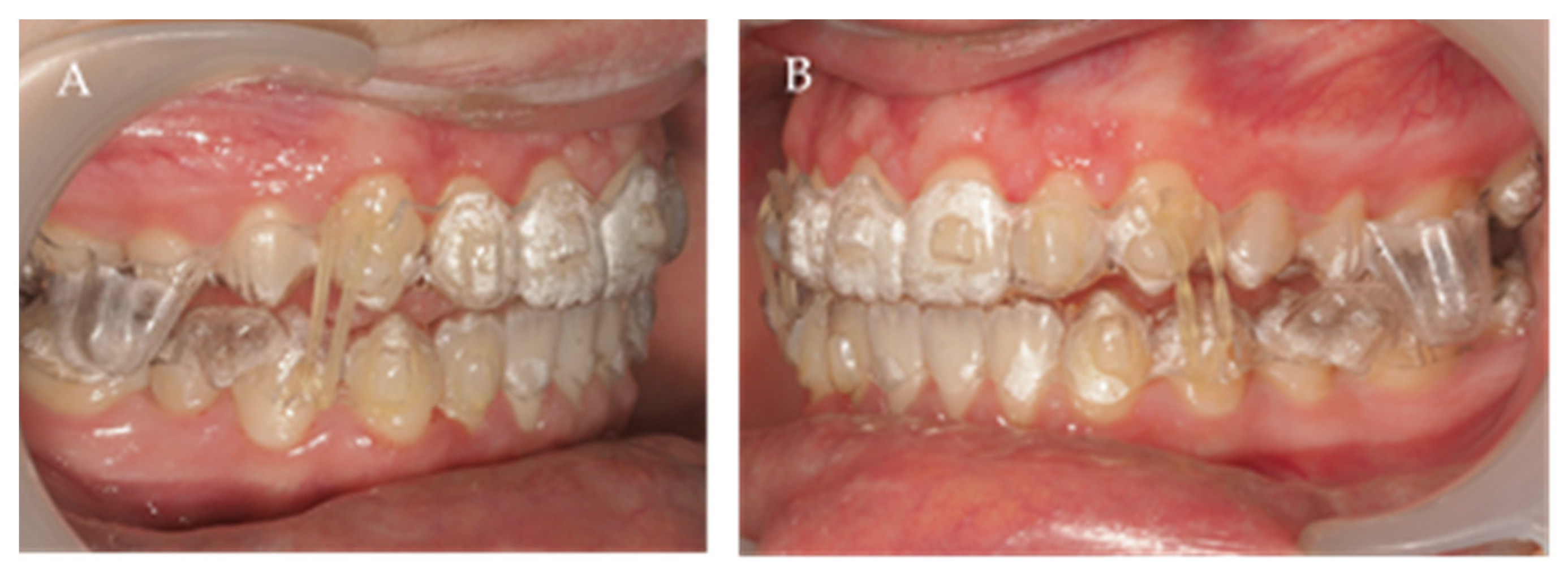 Children 10 00624 g009 Children 10 00624 g009