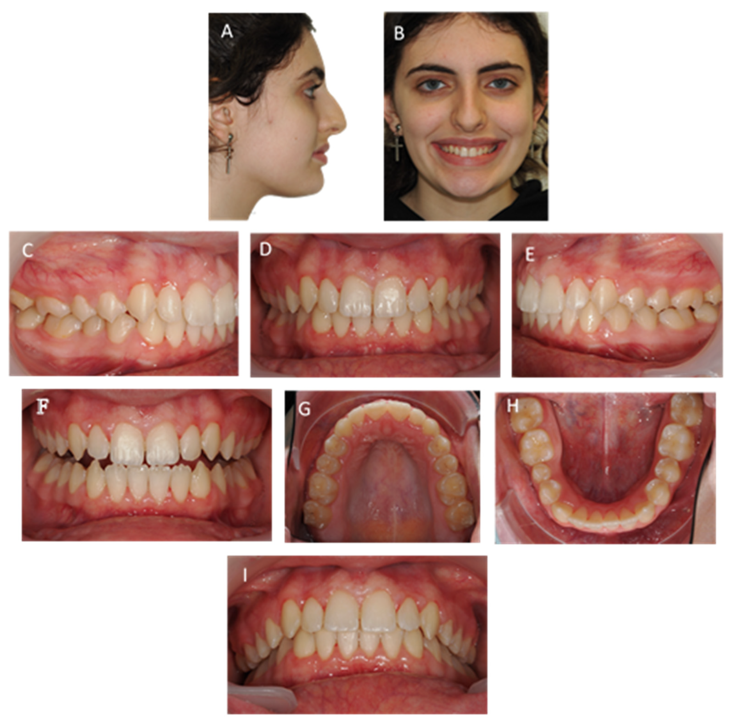 Children 10 00624 g013 Children 10 00624 g013