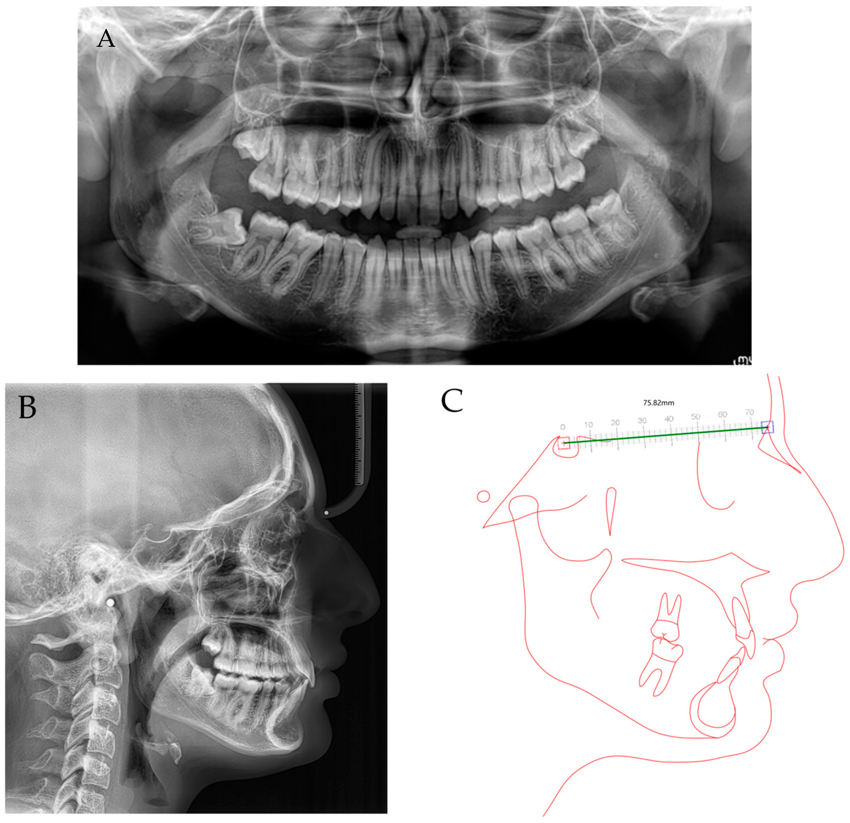 Children 10 00624 g014 Children 10 00624 g014