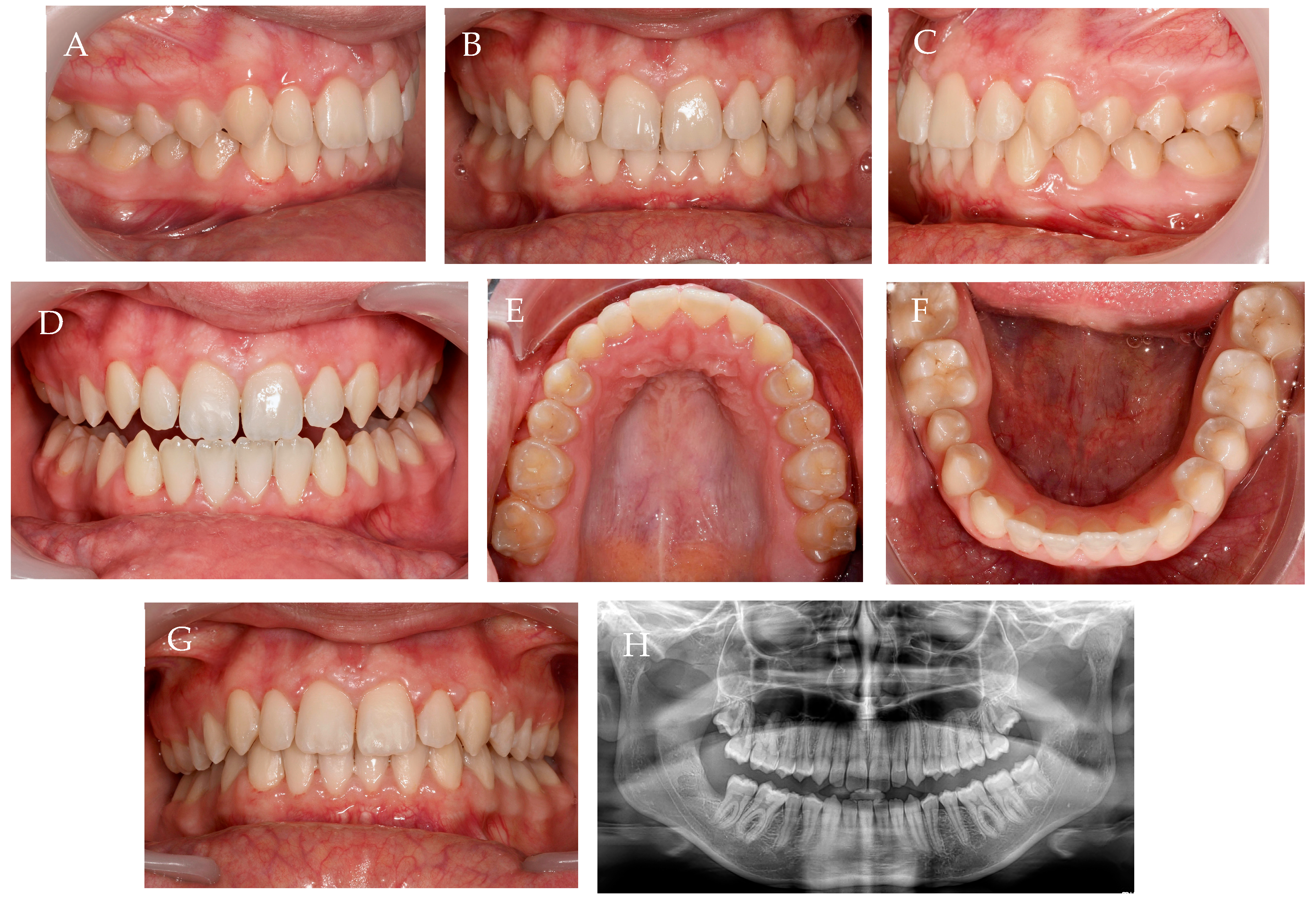 Children 10 00624 g016 Children 10 00624 g016