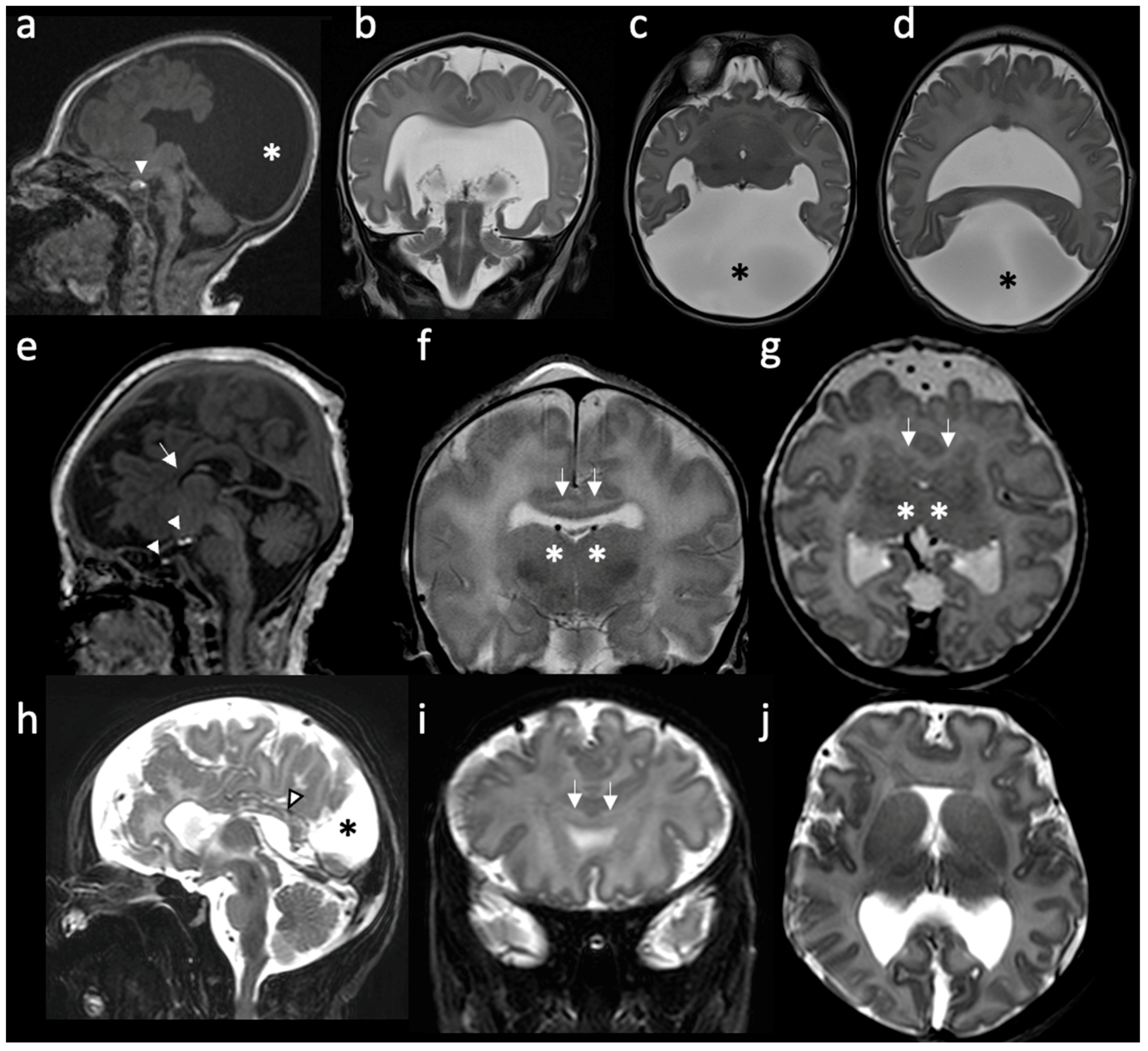 Children 10 00647 g001 Children 10 00647 g001