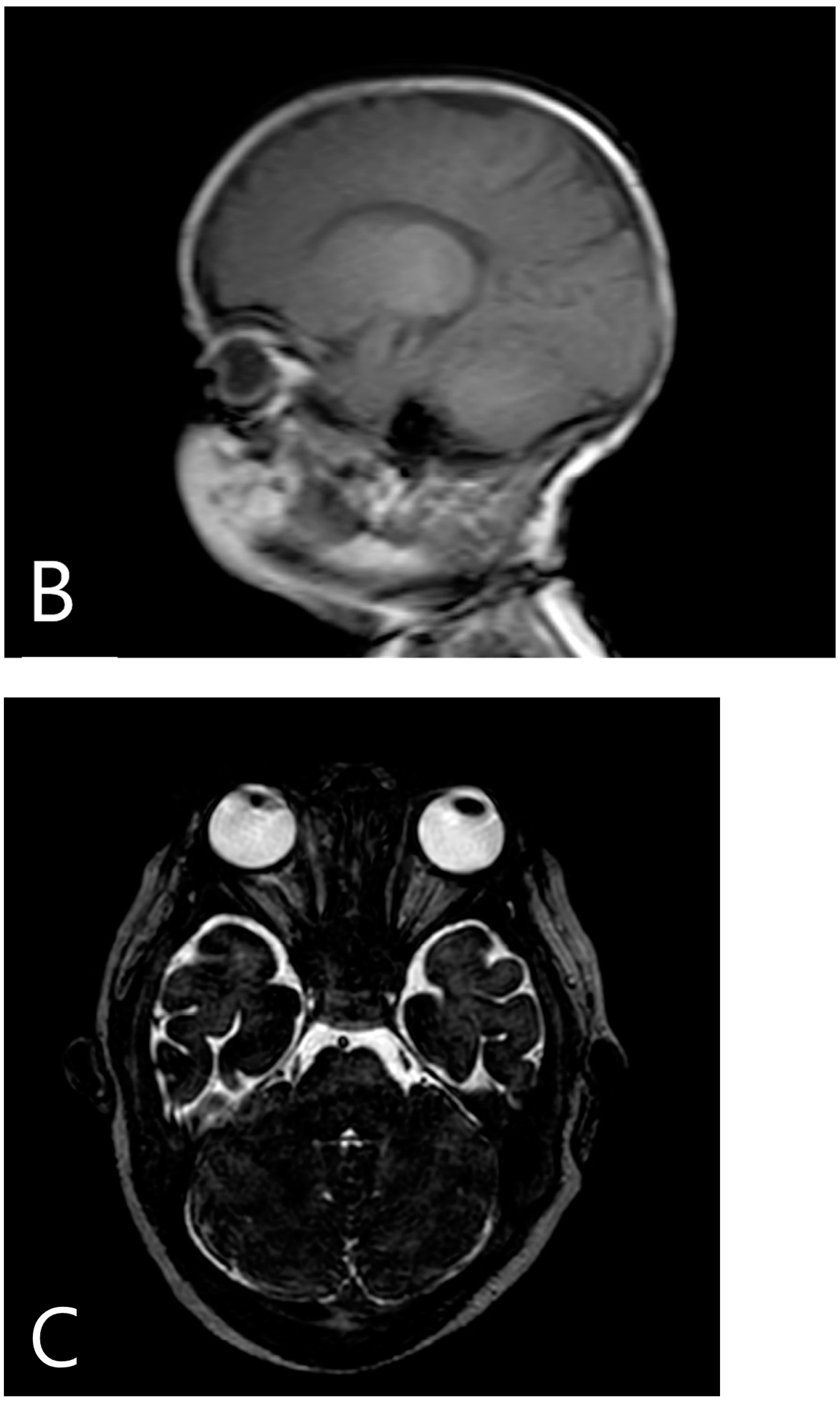 Children 10 00675 g001b Children 10 00675 g001b