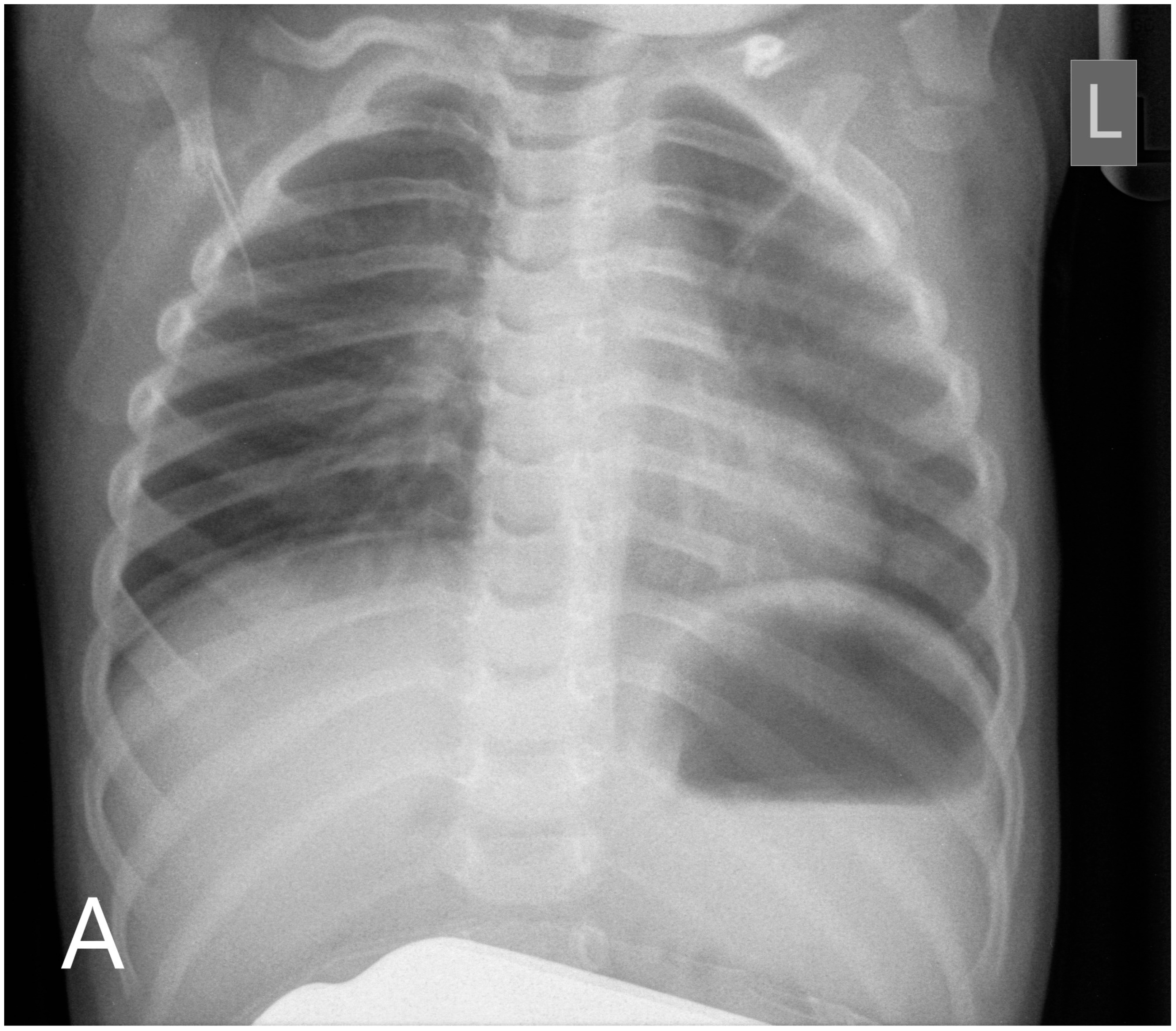 Children 10 00675 g002a Children 10 00675 g002a