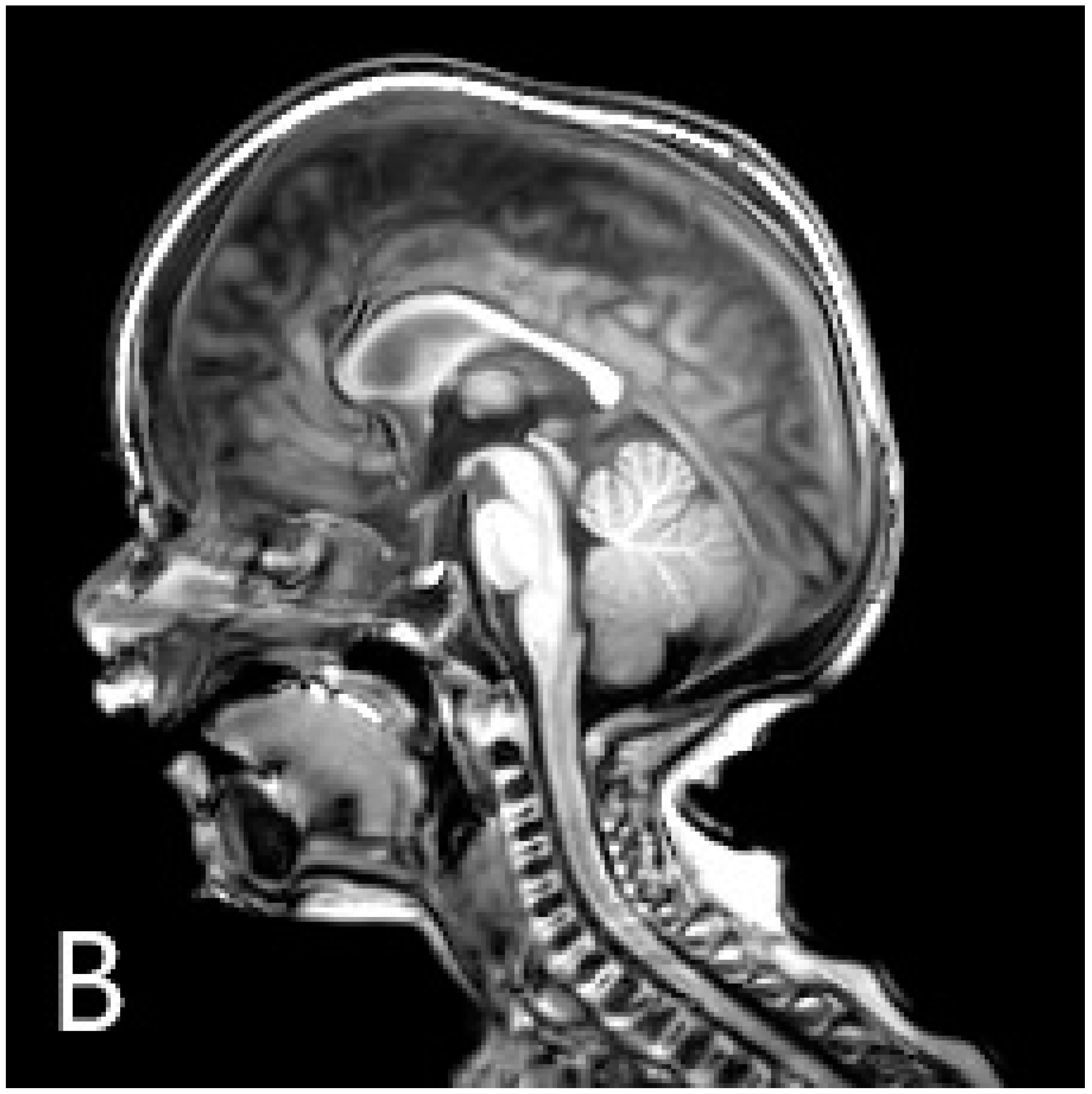 Children 10 00675 g002b Children 10 00675 g002b