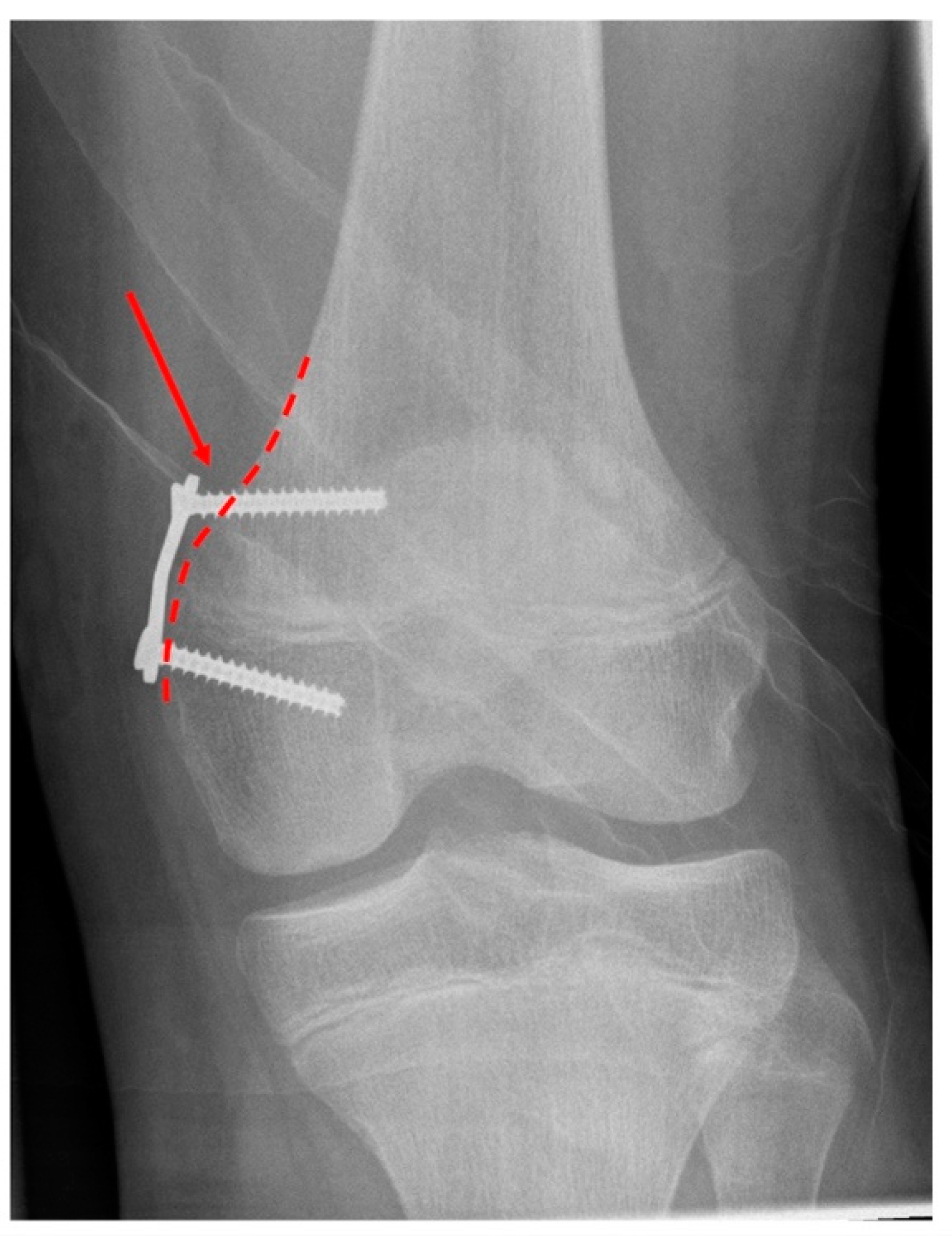Children Free FullText Factors for Prolonged Pain and Restriction