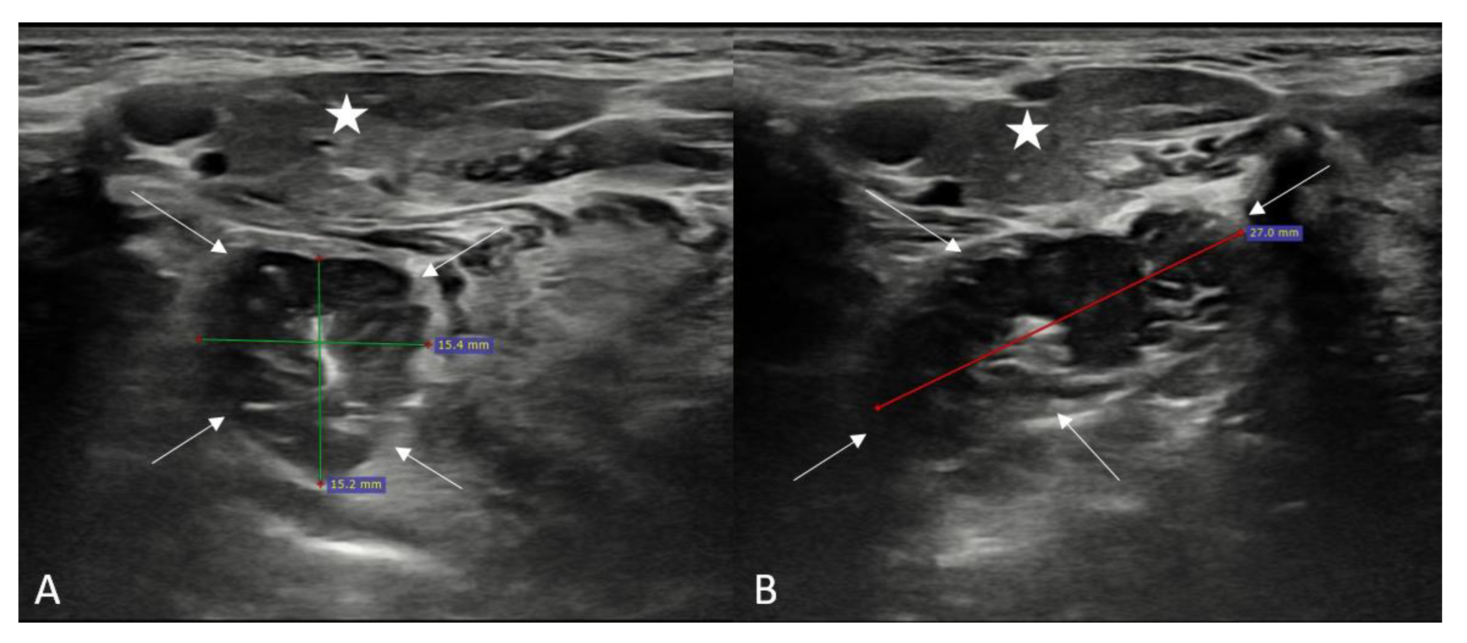 Children 10 00704 g001 Children 10 00704 g001