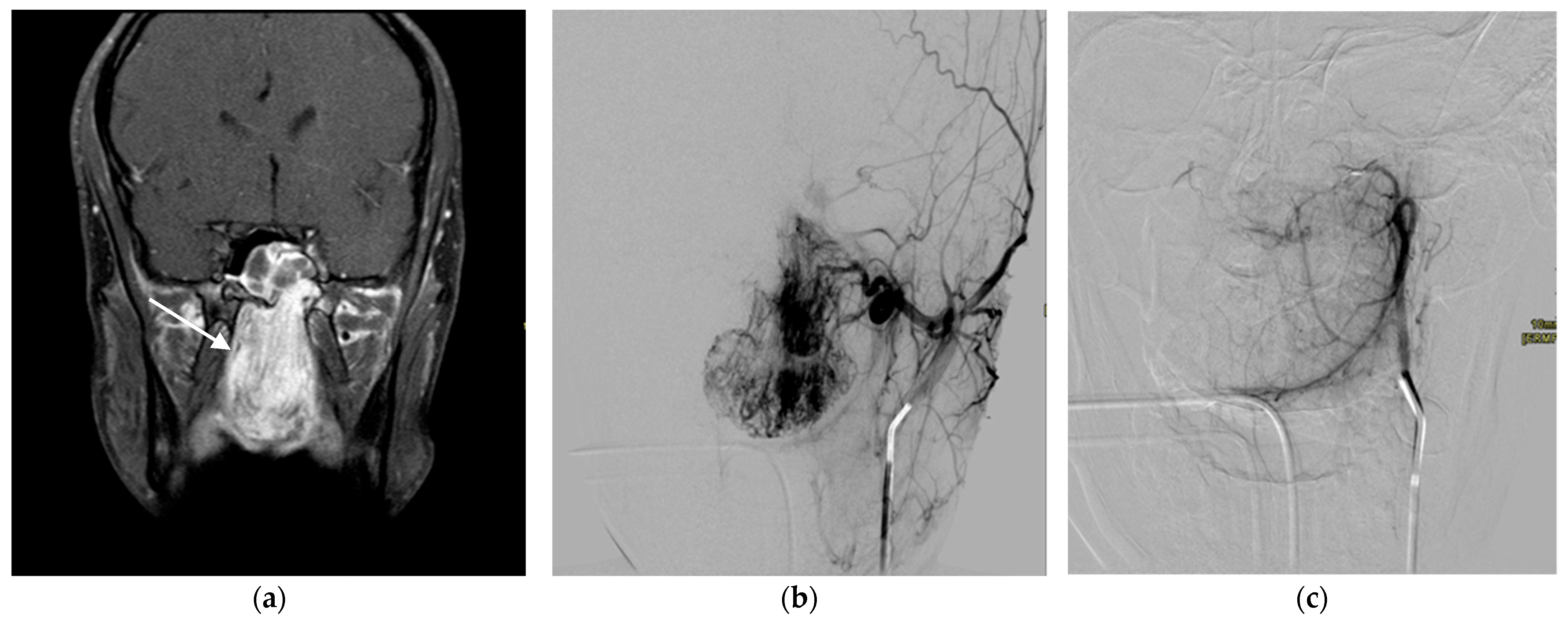 Children 10 00715 g005
