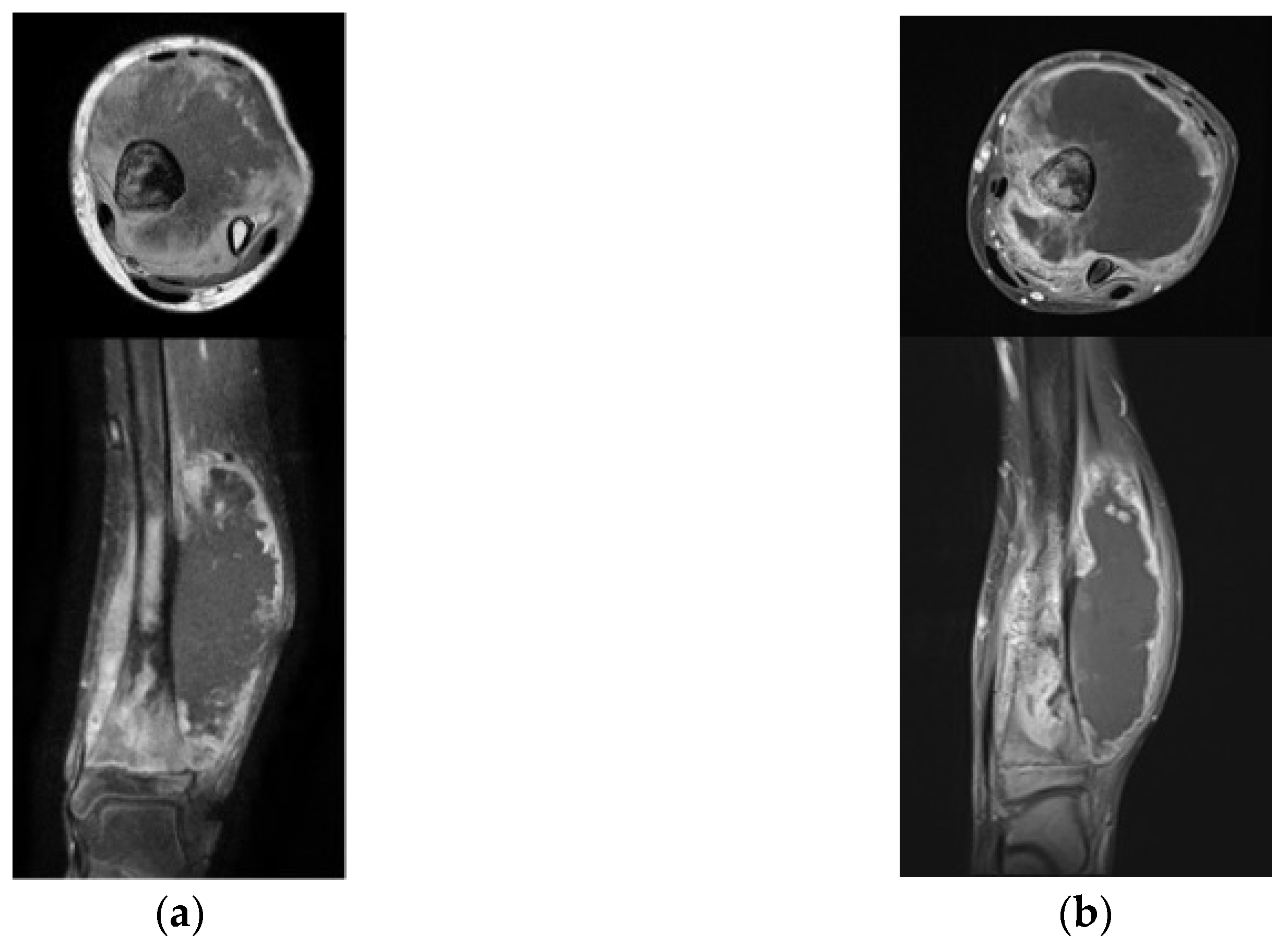 Children 10 00736 g002 Children 10 00736 g002