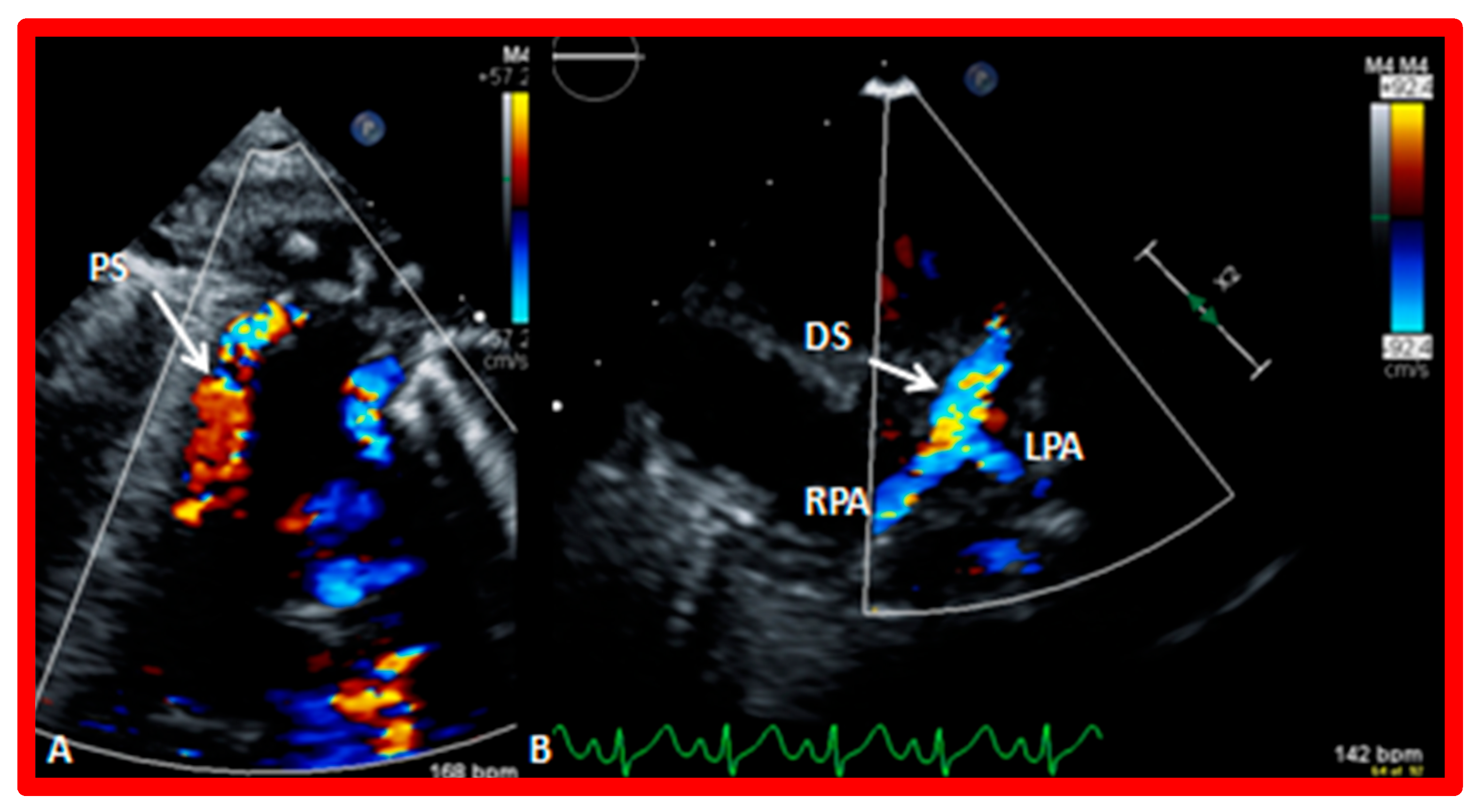 Children 10 00739 g002 Children 10 00739 g002