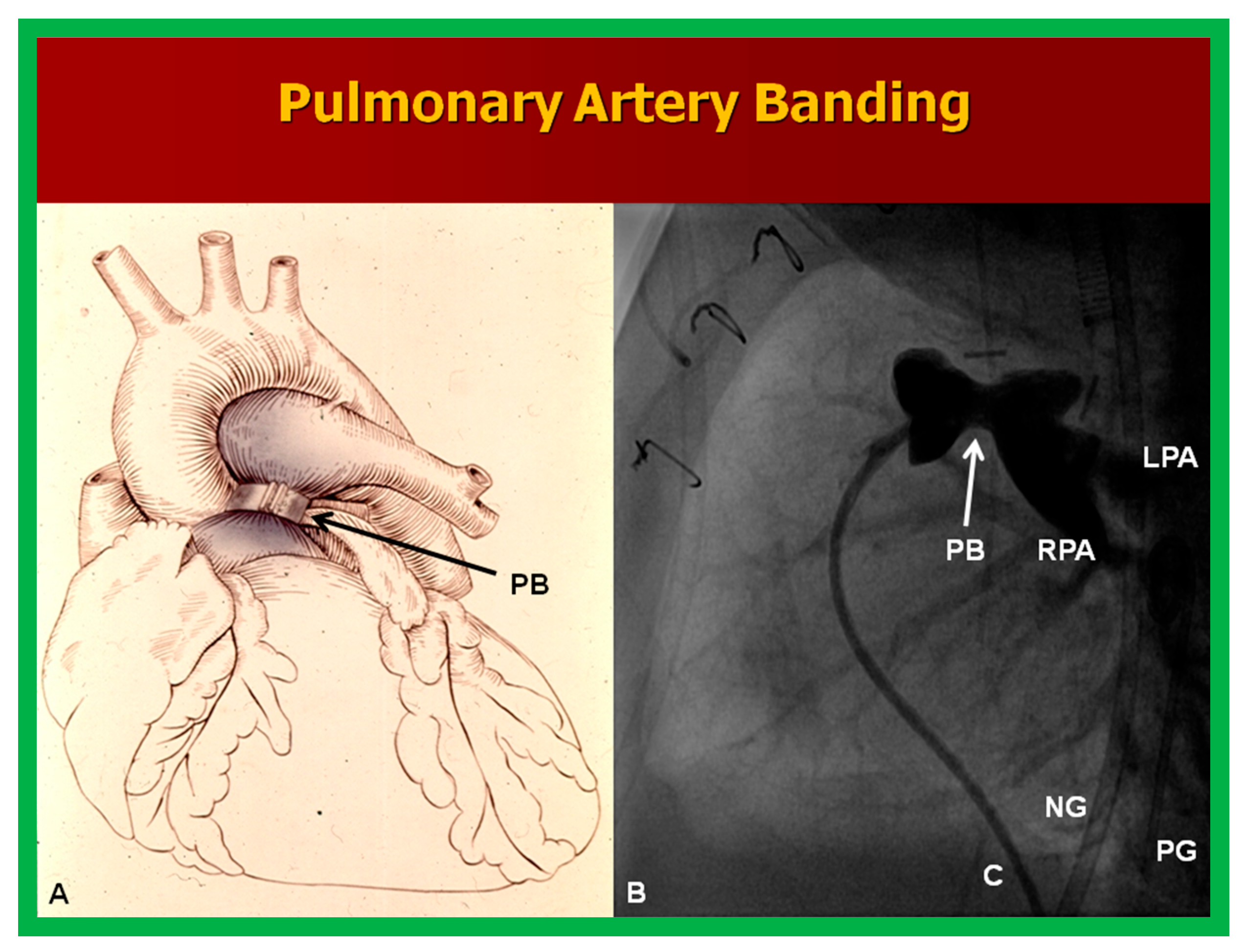 Children 10 00739 g003 Children 10 00739 g003