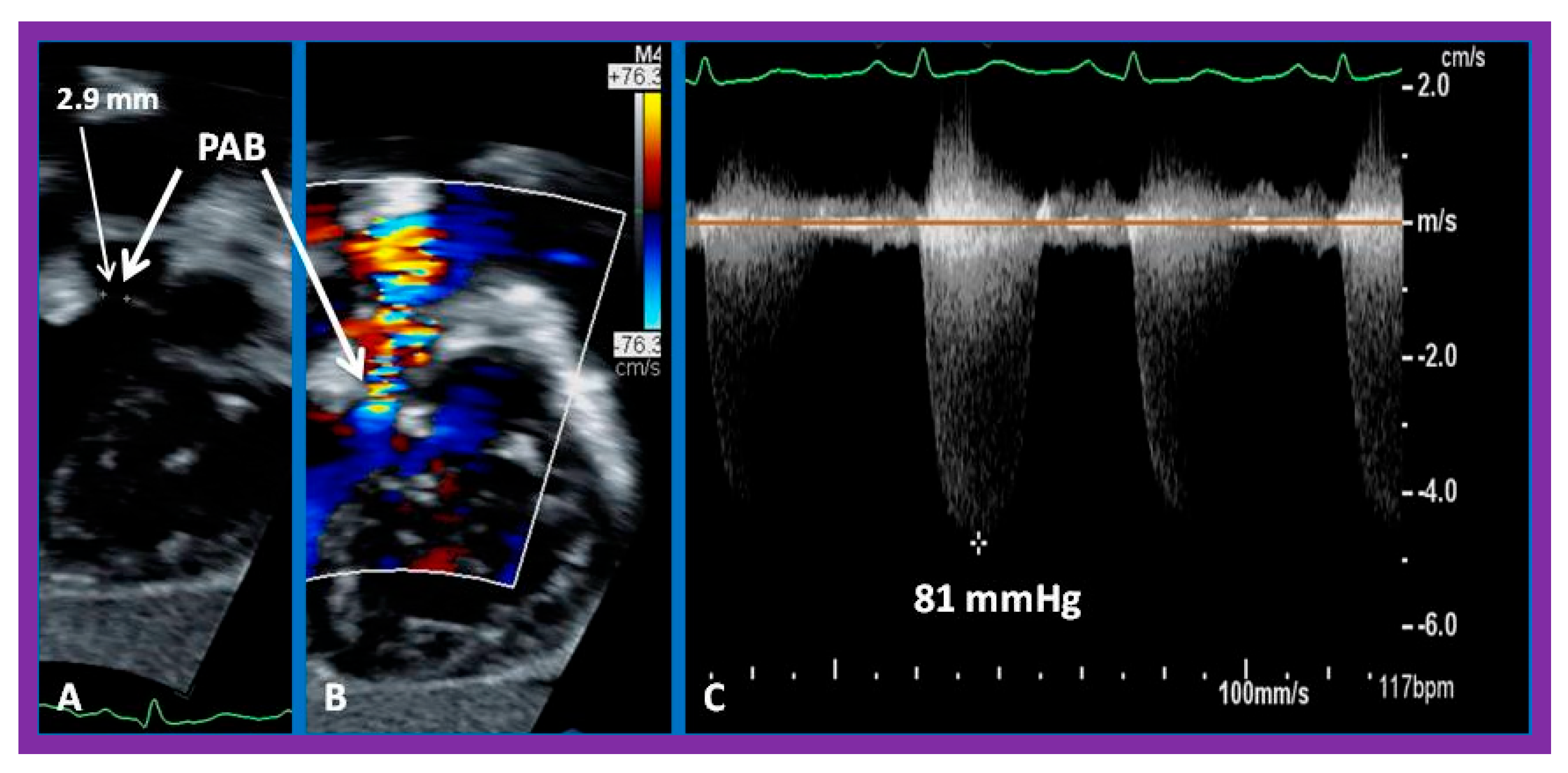 Children 10 00739 g004 Children 10 00739 g004