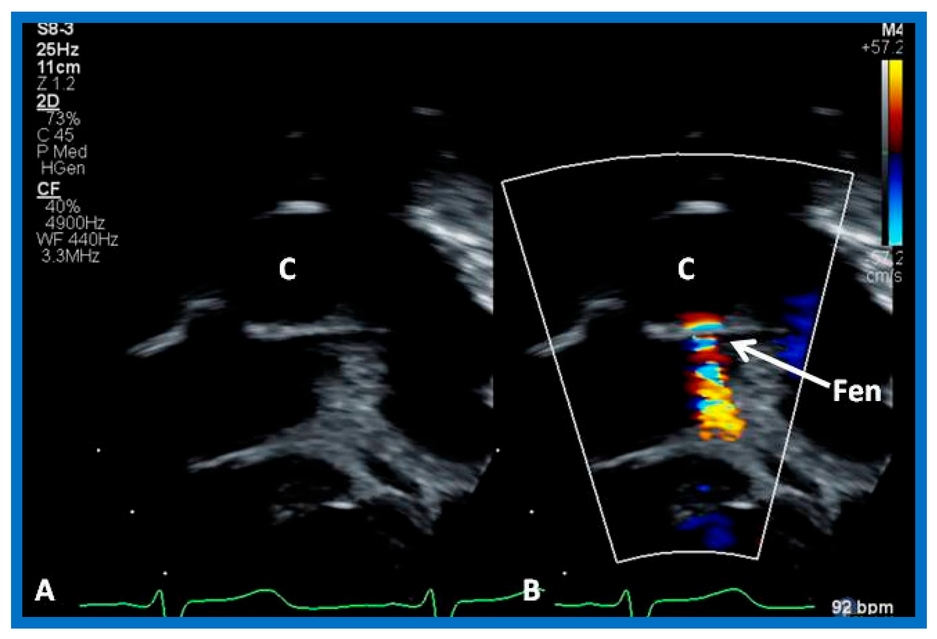 Children 10 00739 g009 Children 10 00739 g009