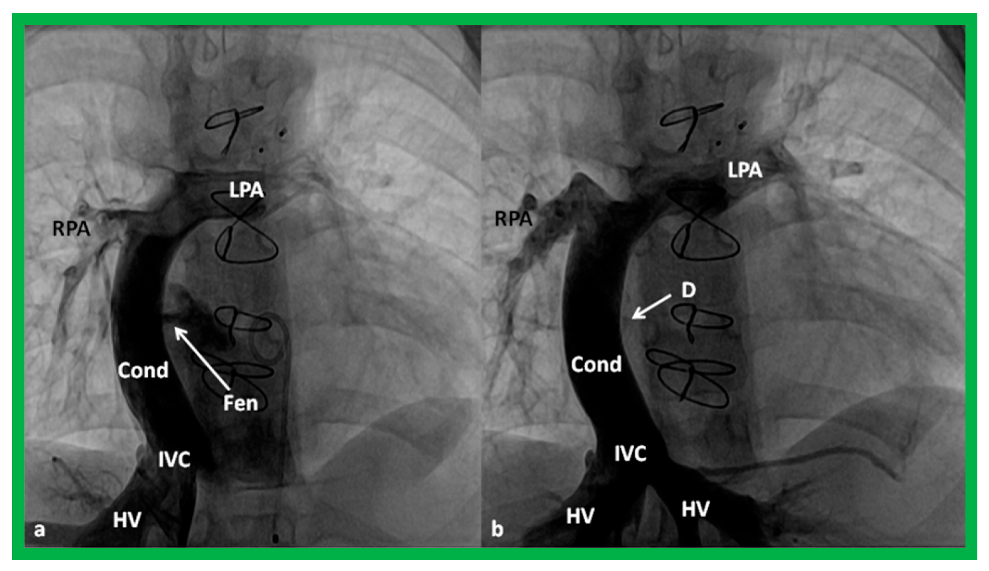 Children 10 00739 g011 Children 10 00739 g011