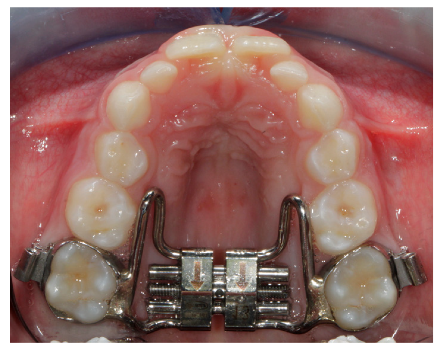 Children 10 00775 g001 Children 10 00775 g001