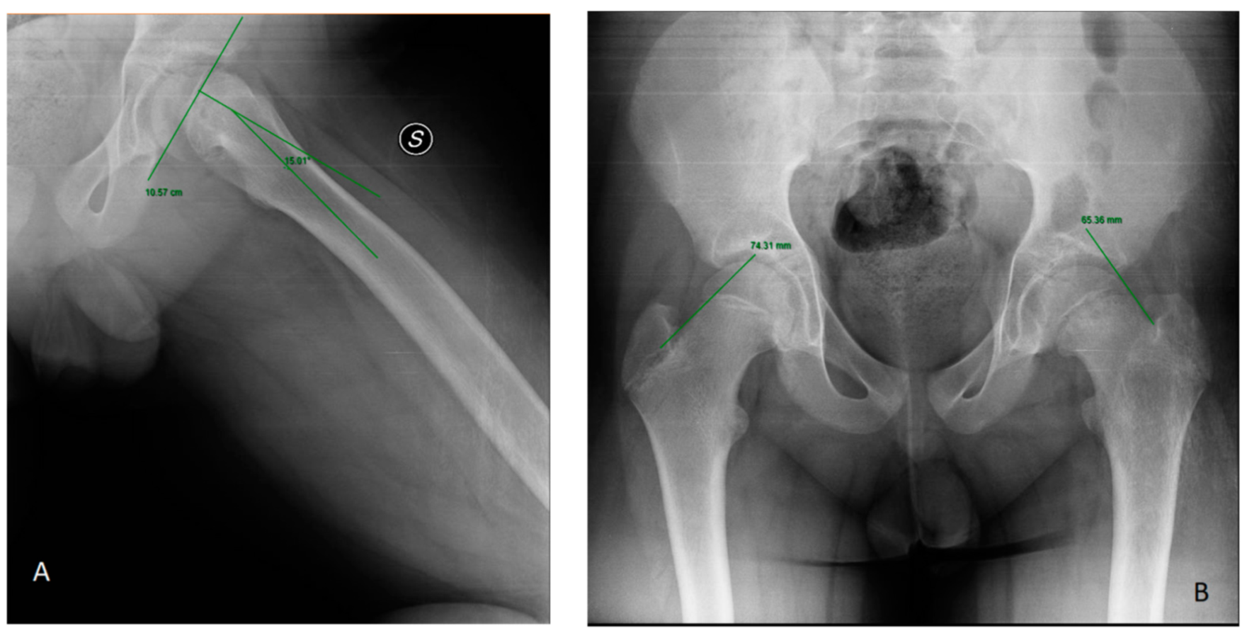 Children 10 00778 g002 Children 10 00778 g002