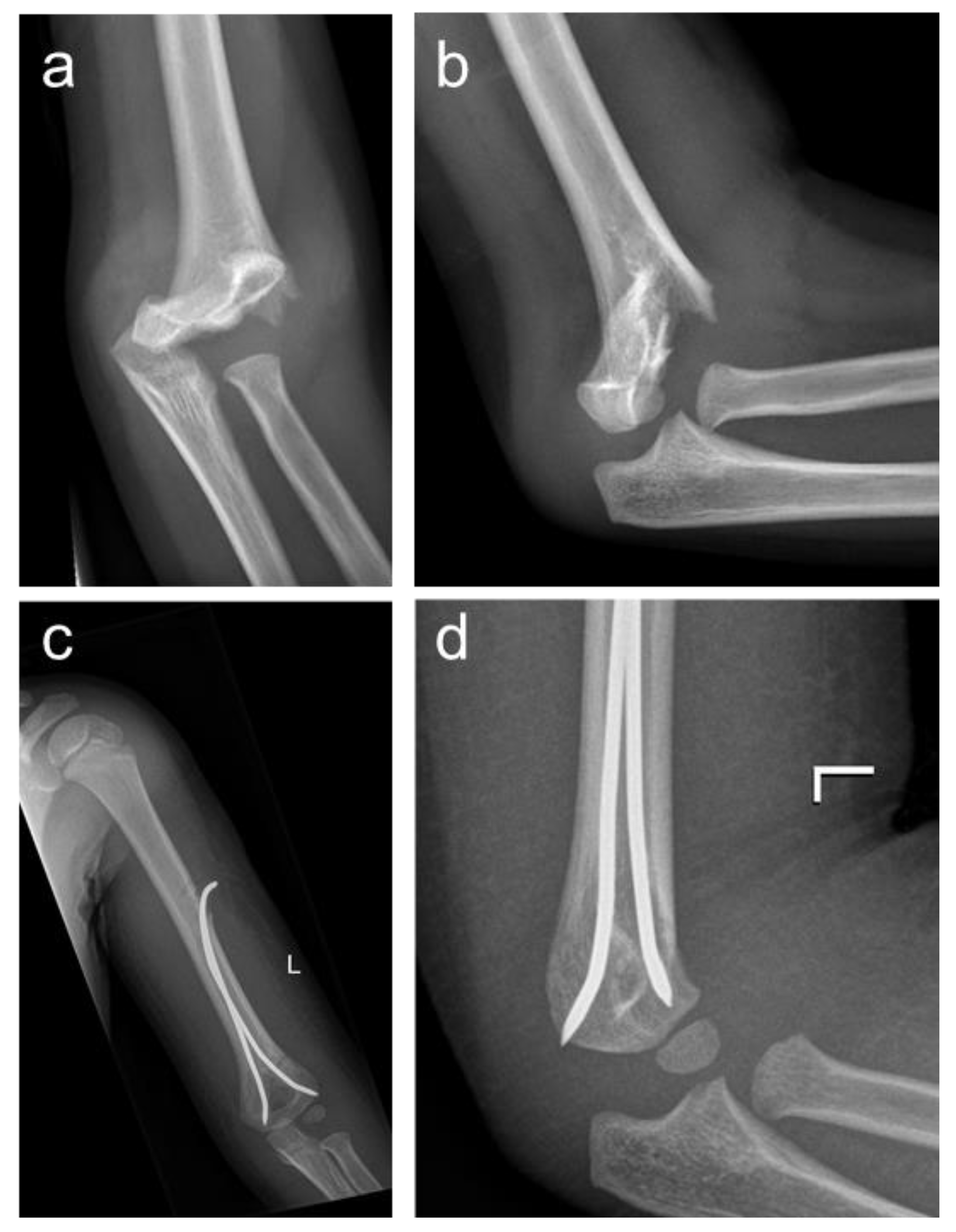 Children 10 00830 g002 Children 10 00830 g002