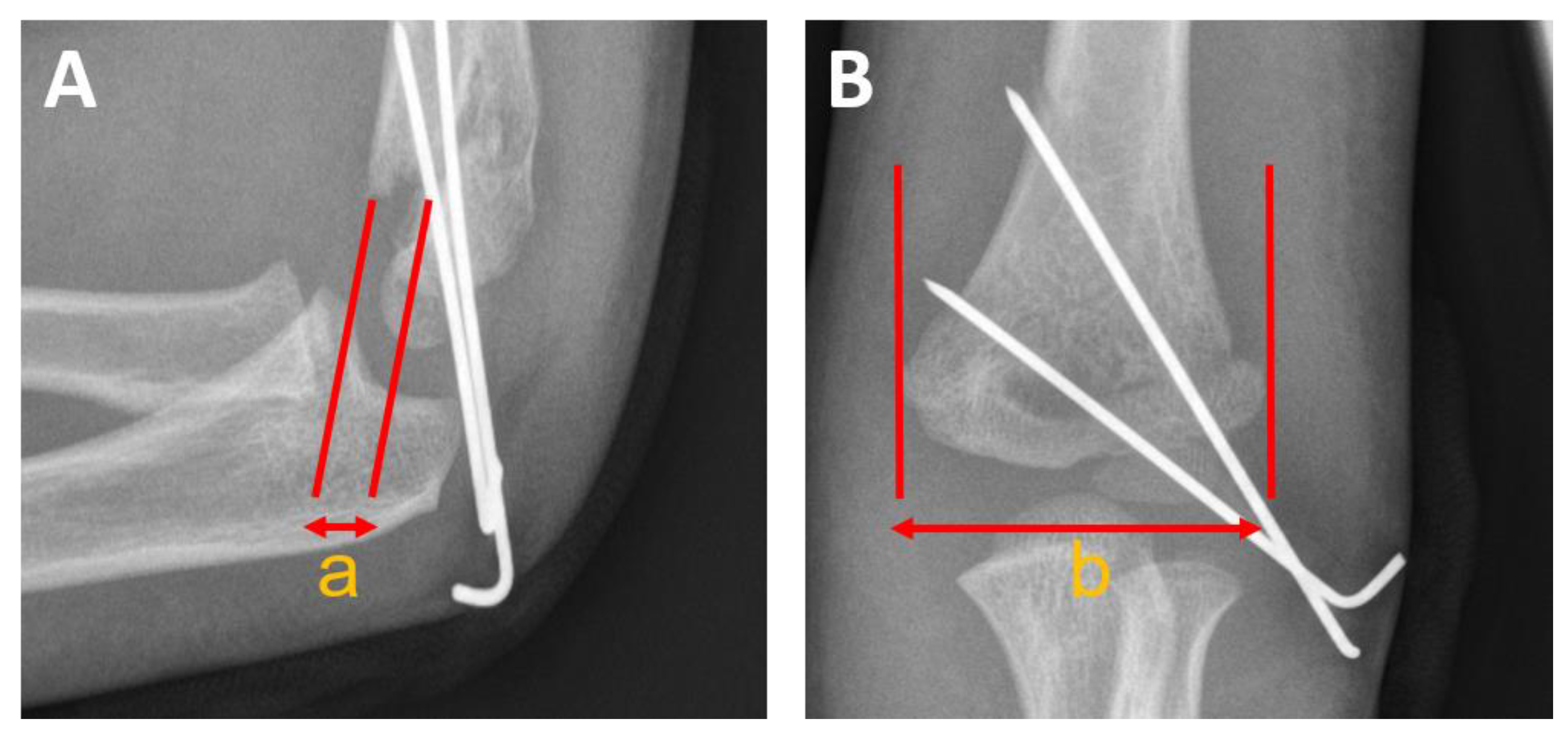 Children 10 00830 g003 Children 10 00830 g003